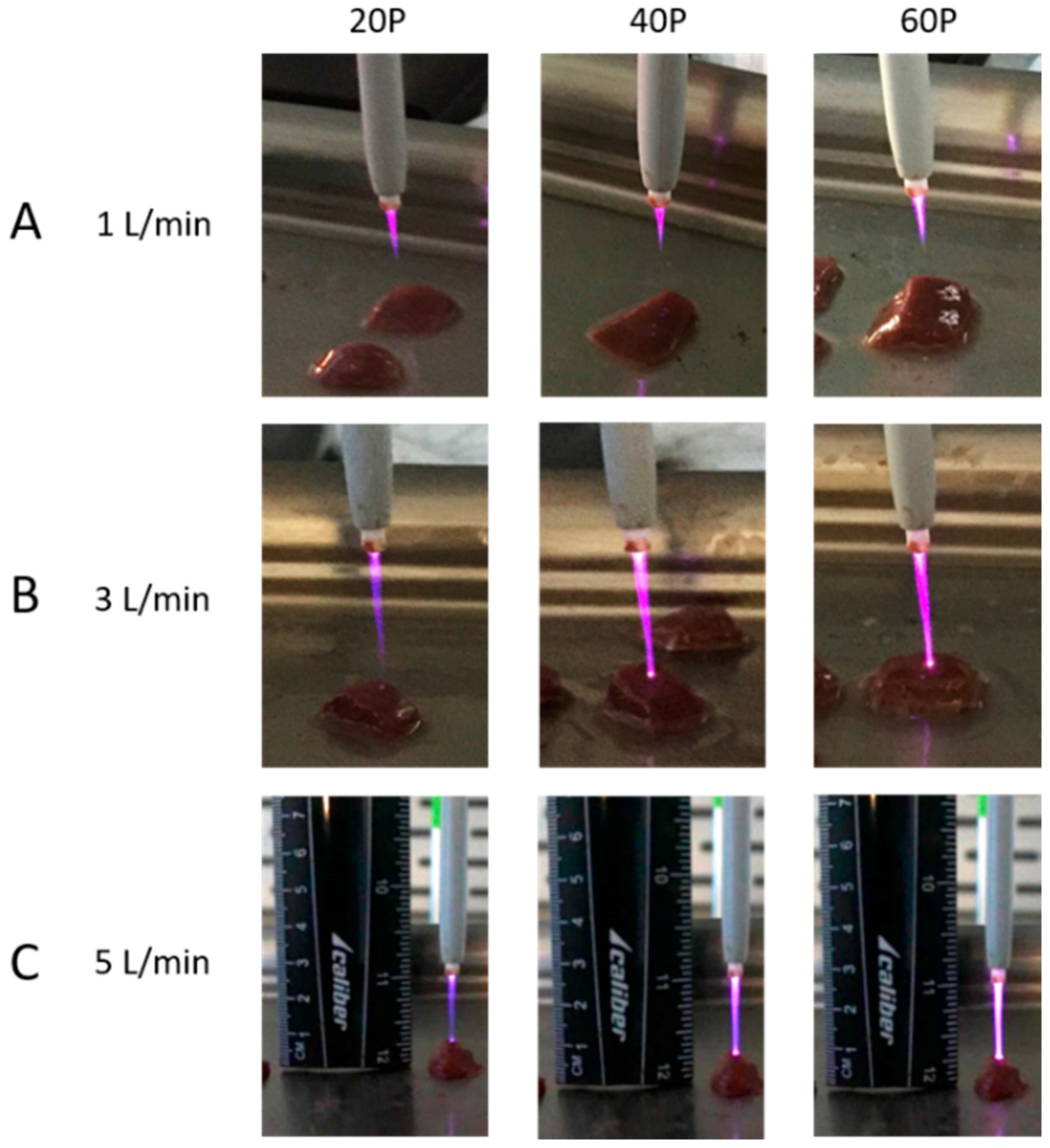 Plasma 01 00017 g004 Plasma 01 00017 g004