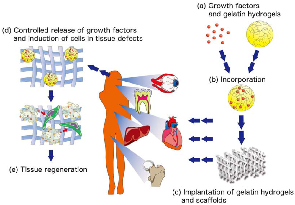 Polymers Free FullText Regeneration Approaches for Dental Pulp and