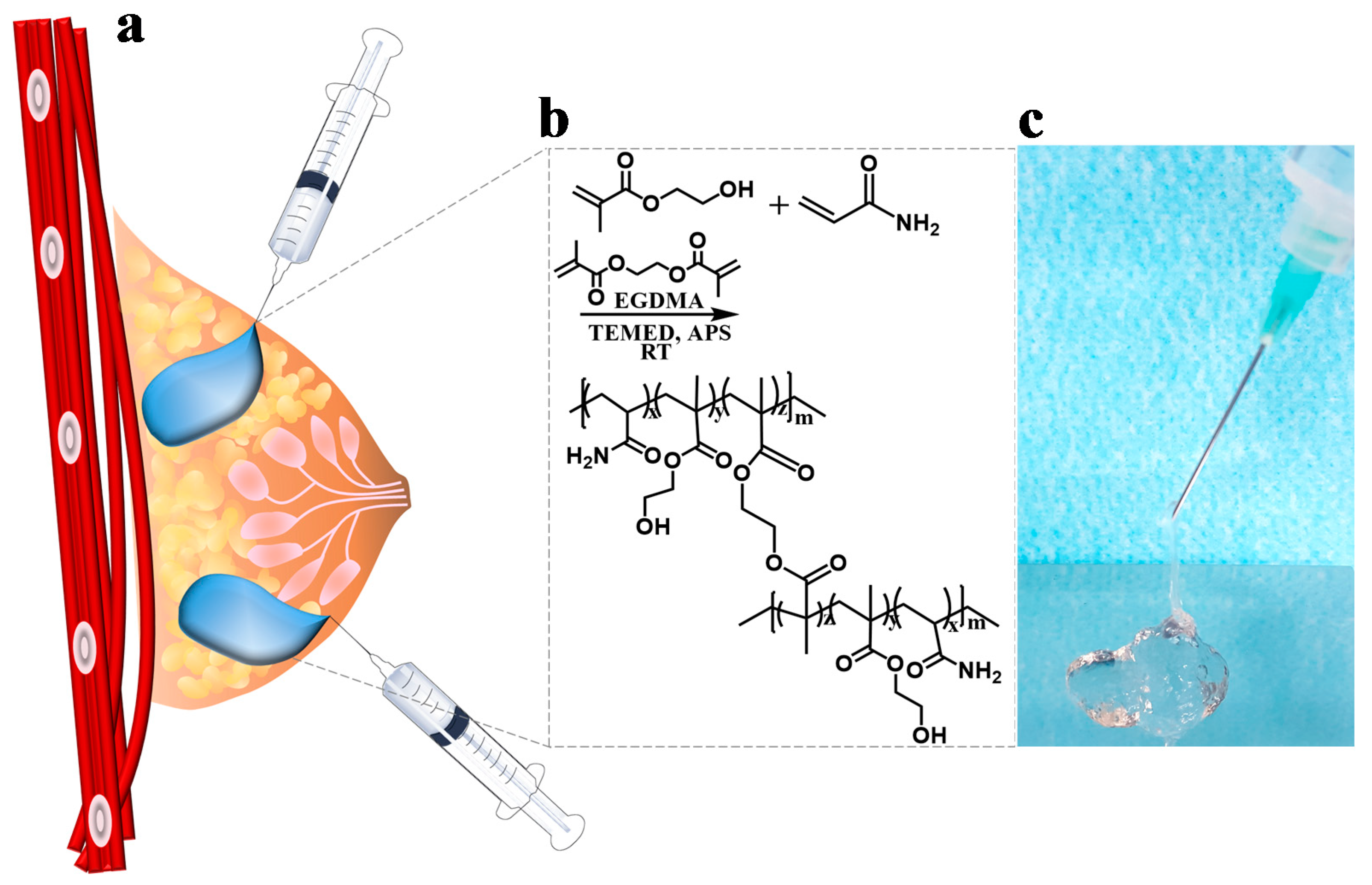 Polymers | Free Full-Text | Development of Poly(HEMA-Am) Polymer Hydrogel Filler for Soft Tissue Reconstruction by Facile Polymerization