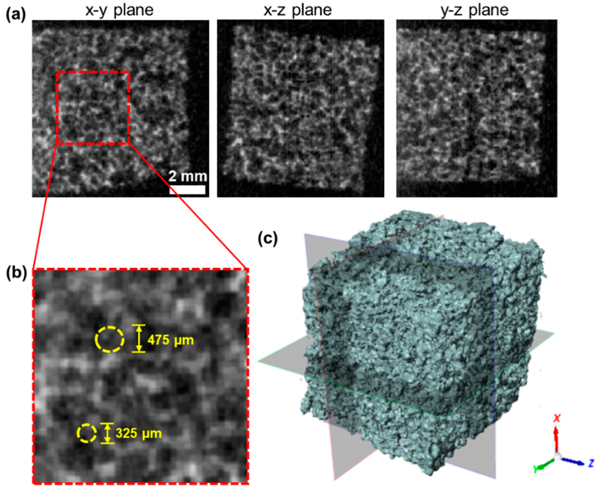Polymers Free Full Text Shape Memory Polyurethane With Porous Architectures For Potential Applications In Intracranial Aneurysm Treatment Html