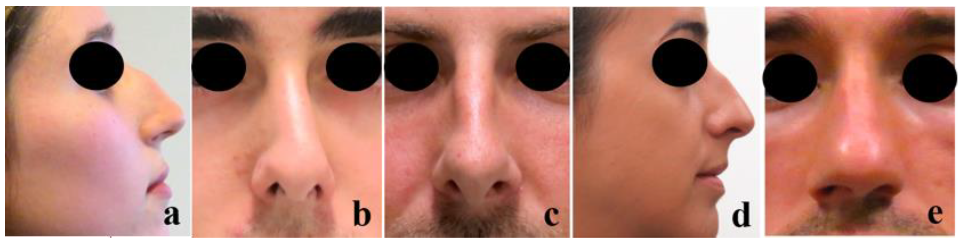 Polymers 12 00177 g002