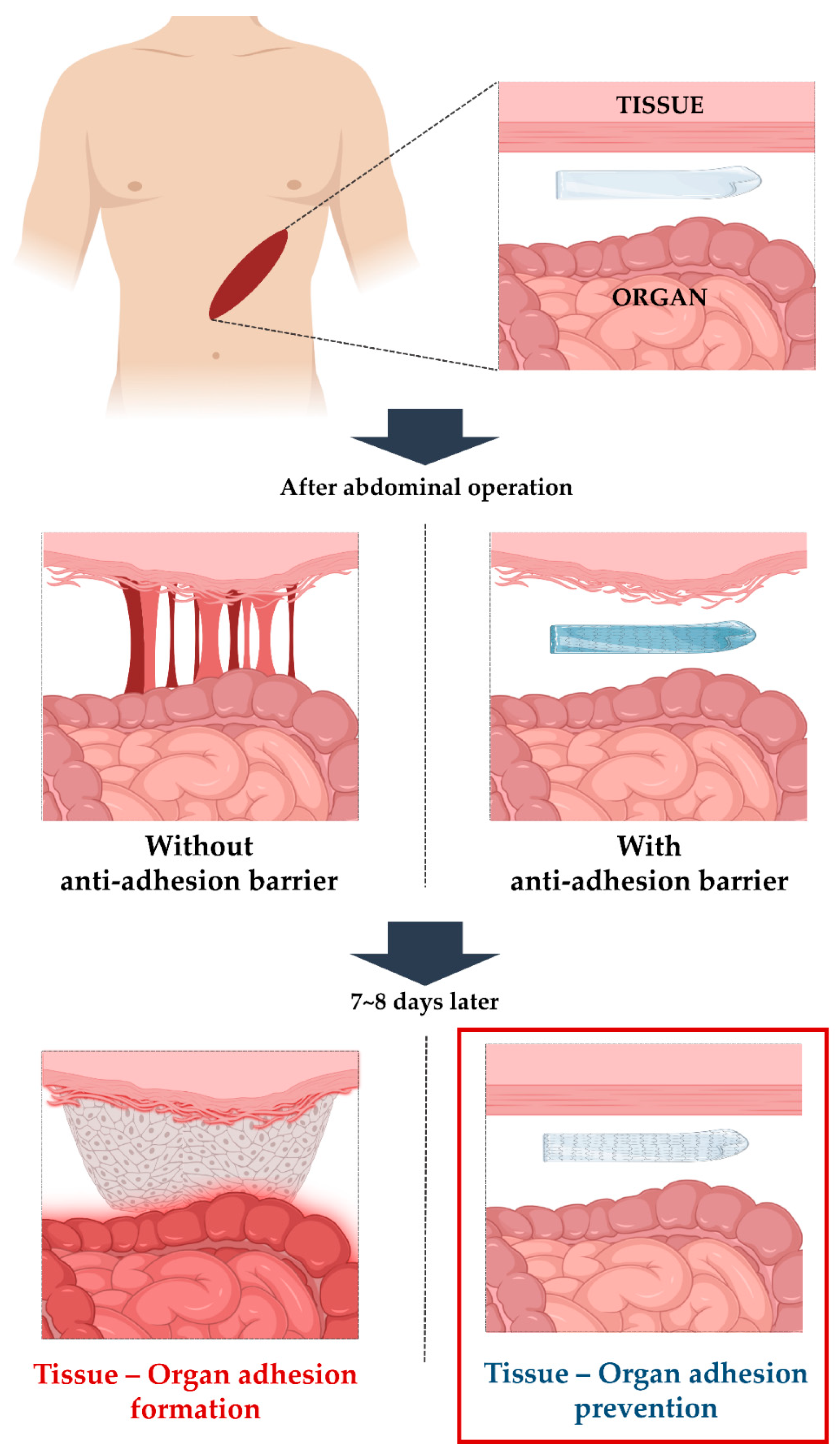 Polymers 12 00618 sch001