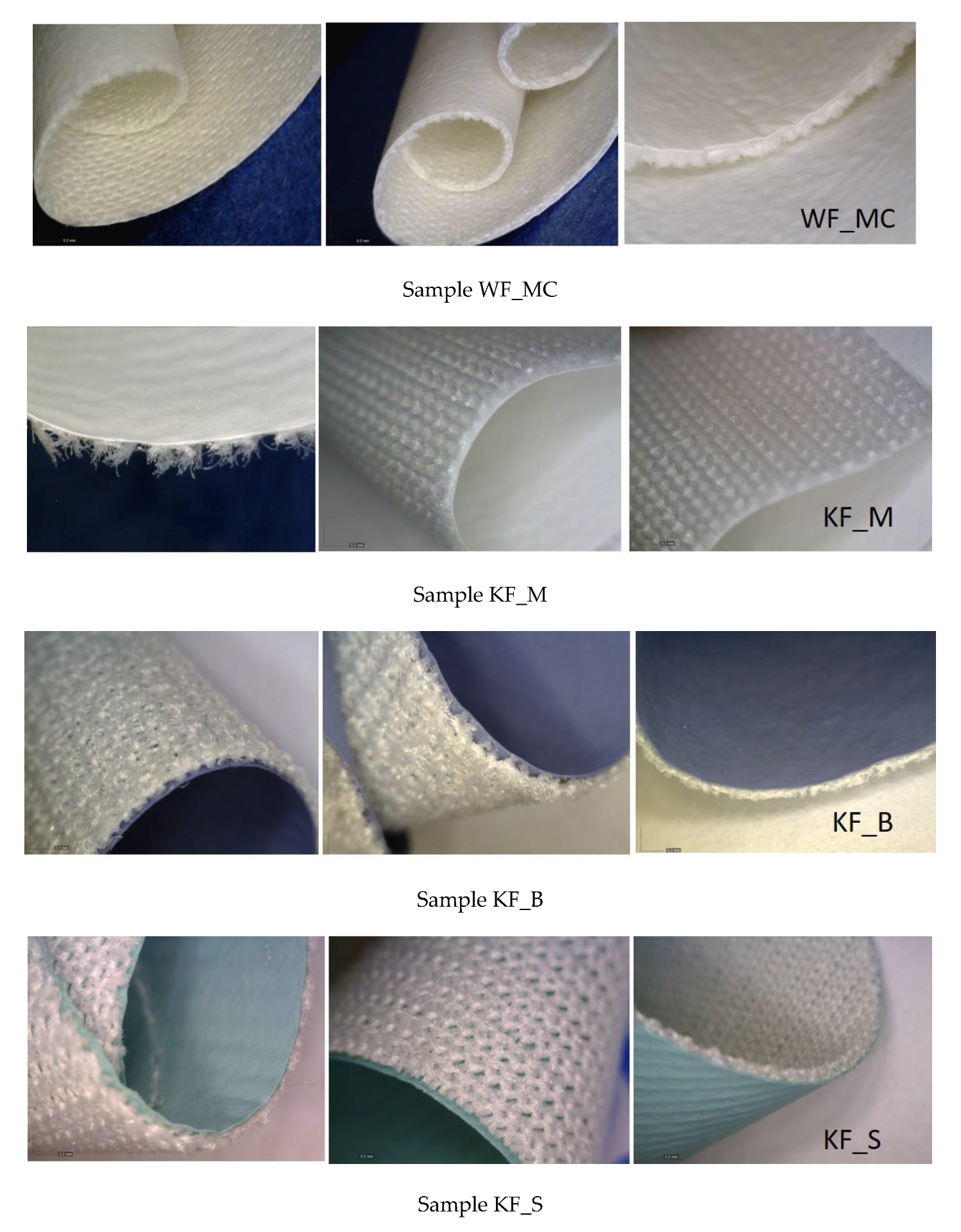 Polymers Free FullText Influence of Washing and Sterilization on