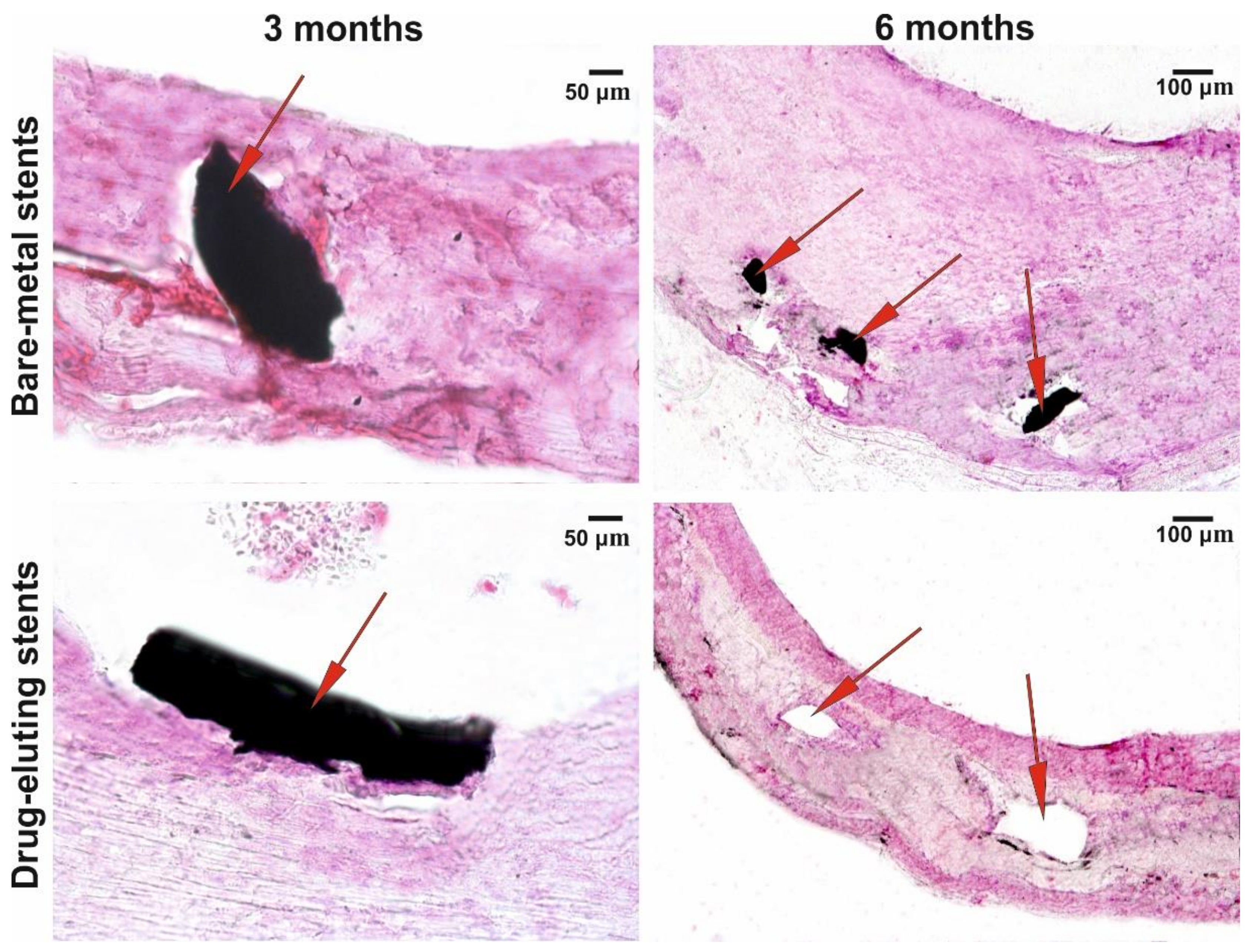 Polymers 12 01741 g006