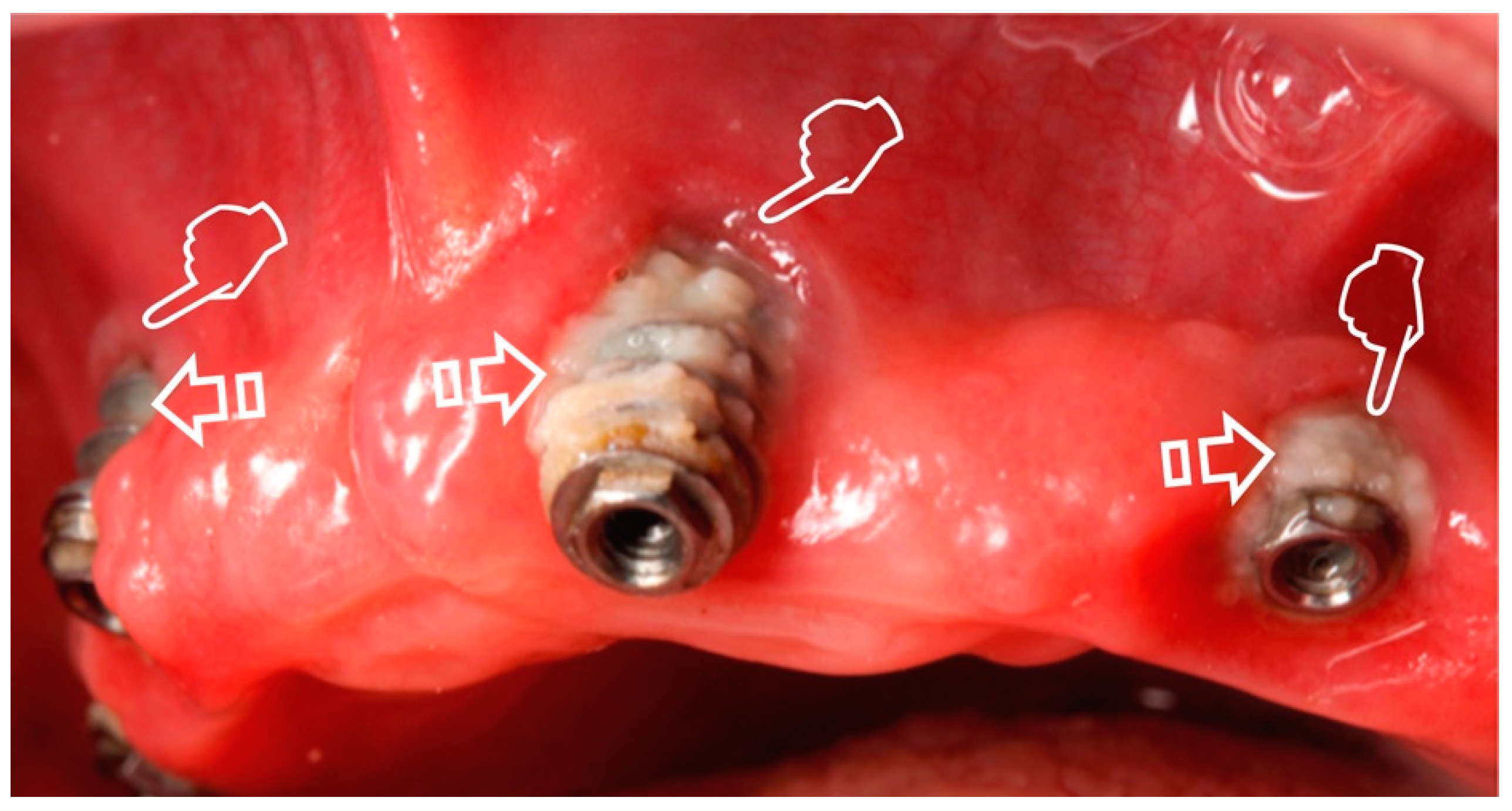 Polymers 12 01850 g002 Polymers 12 01850 g002