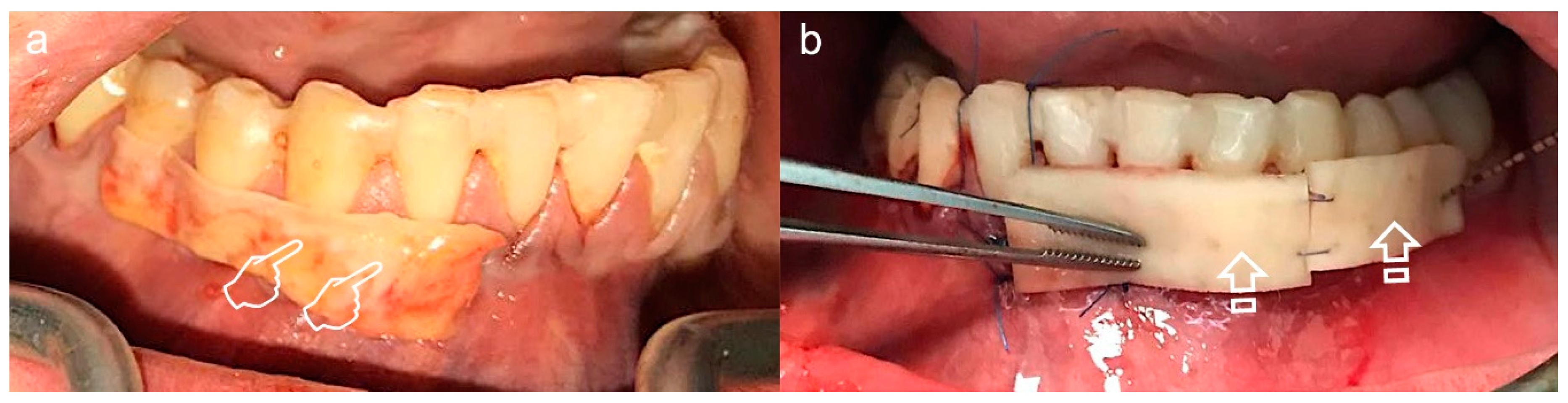 Polymers 12 01850 g004 Polymers 12 01850 g004