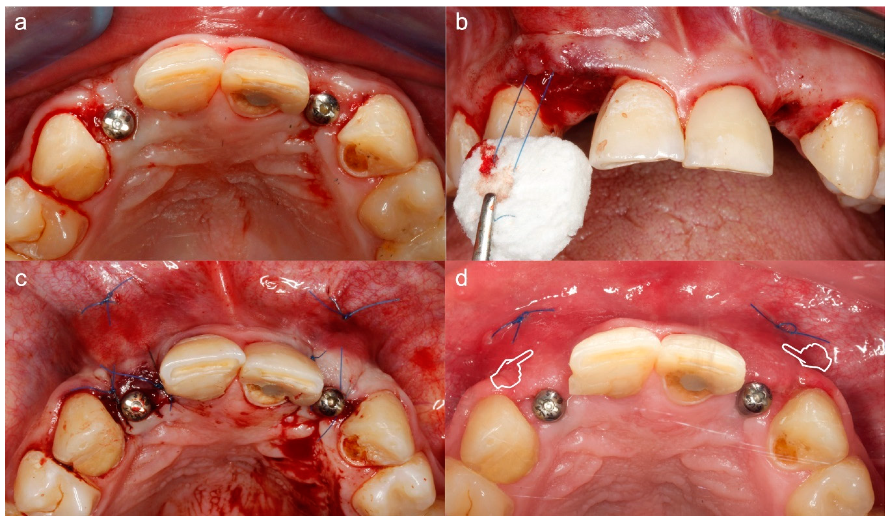Polymers 12 01850 g009 Polymers 12 01850 g009