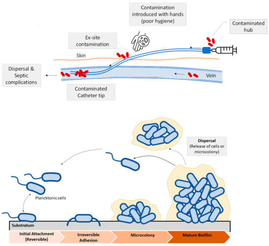 Polymeric Materials with Antibacterial Activity: A Review