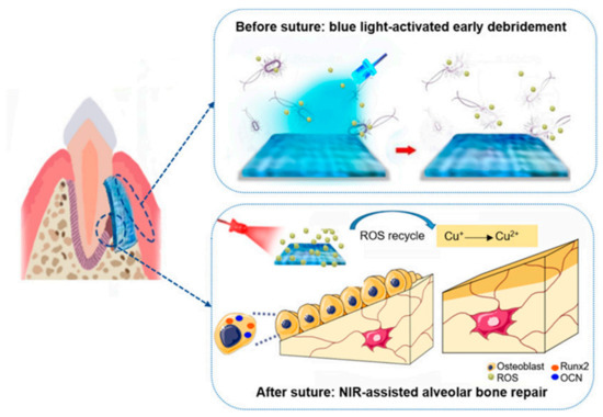 Polymeric Materials with Antibacterial Activity: A Review