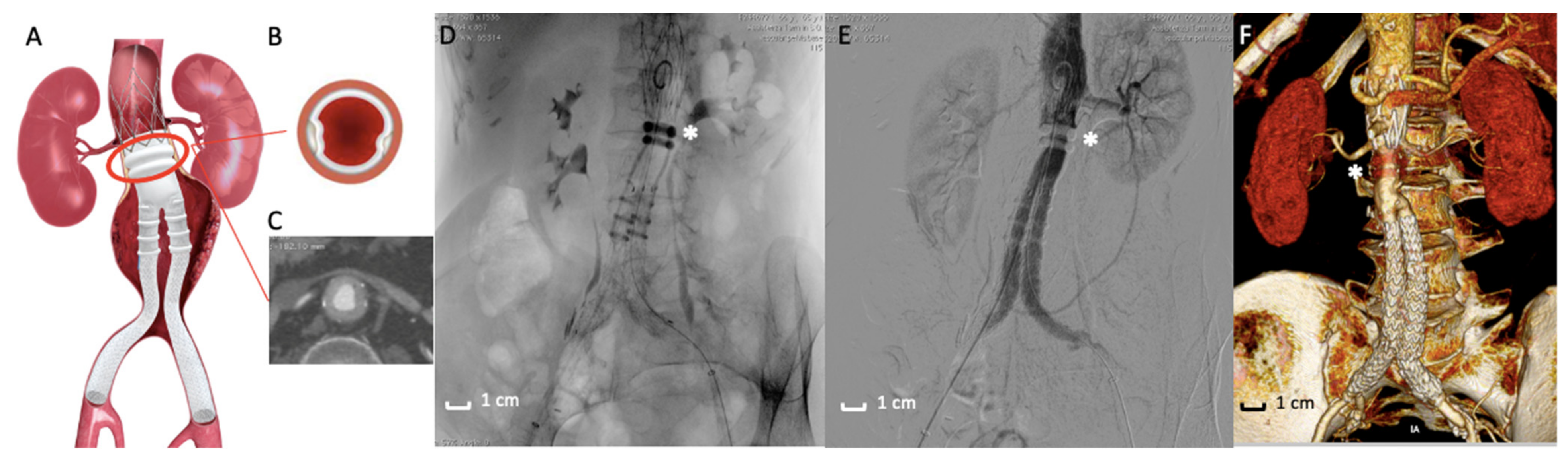 Polymers 13 01196 g003 Polymers 13 01196 g003