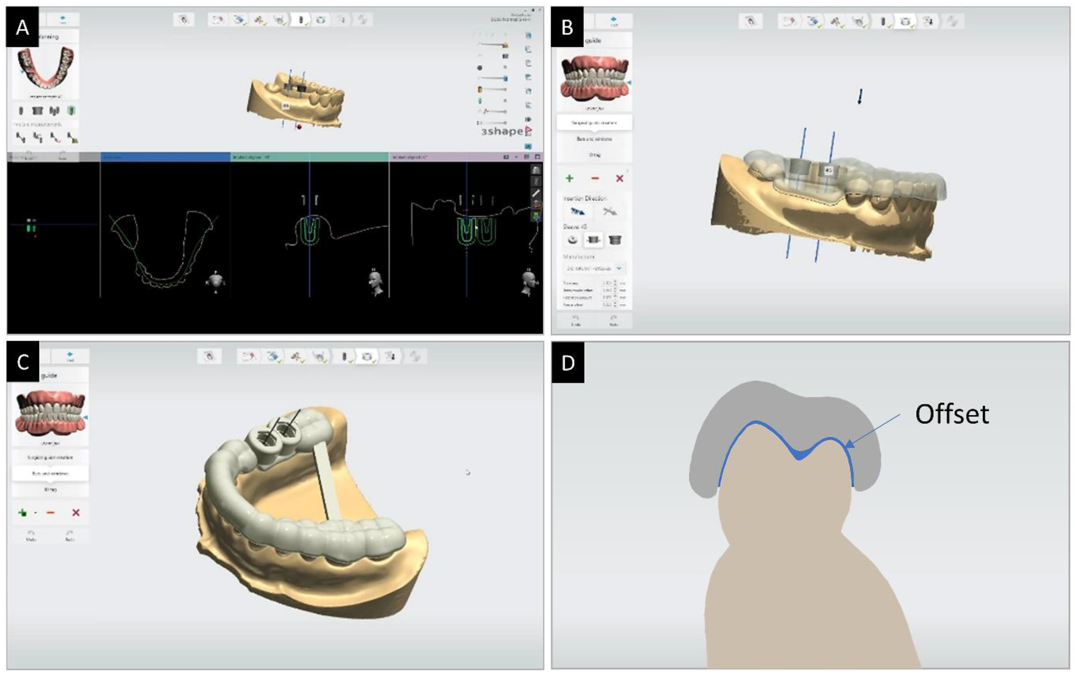 Polymers Free FullText Effects of Groove Sealing of the Posterior