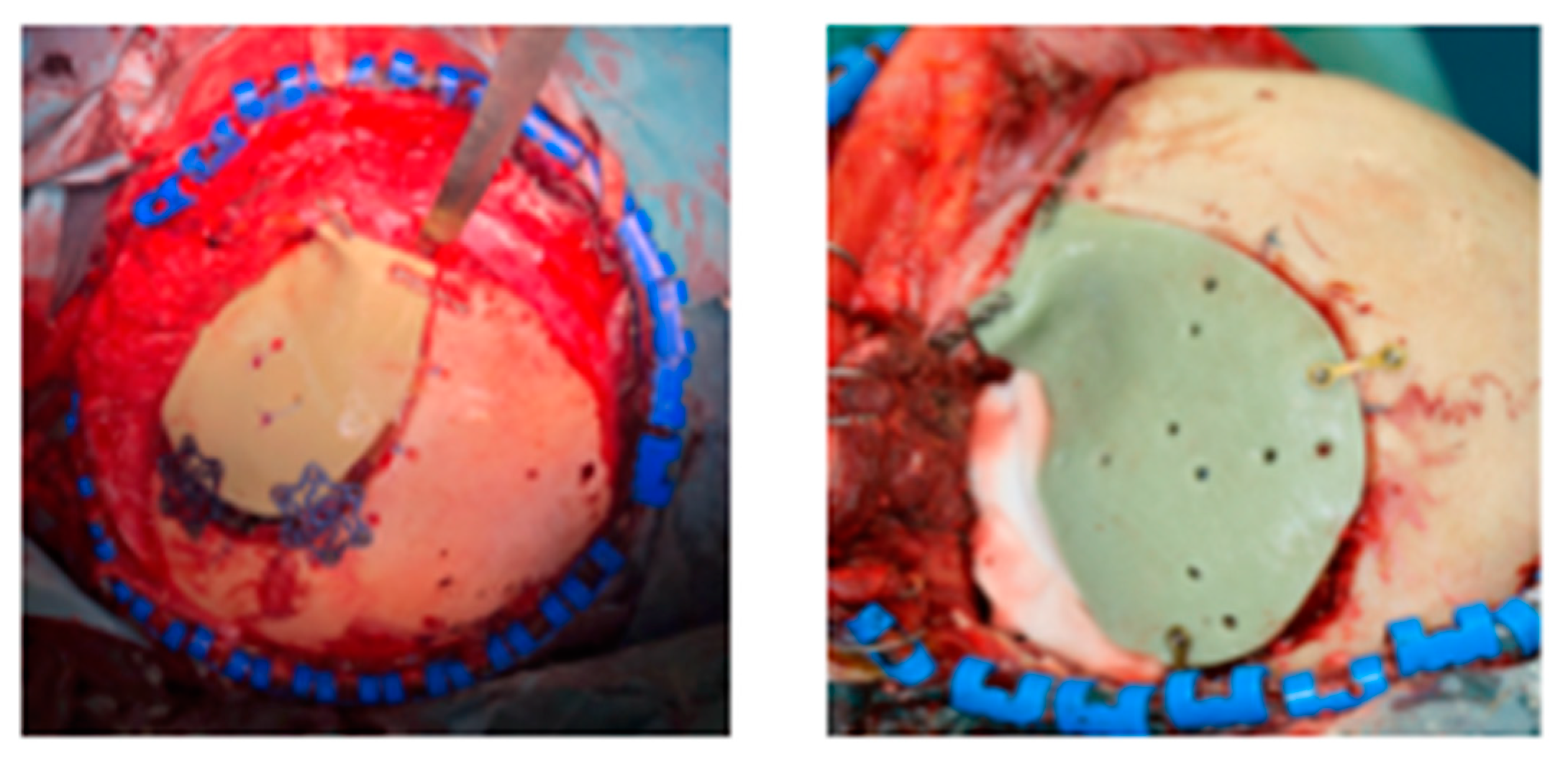 Polymers 13 01452 g004 Polymers 13 01452 g004