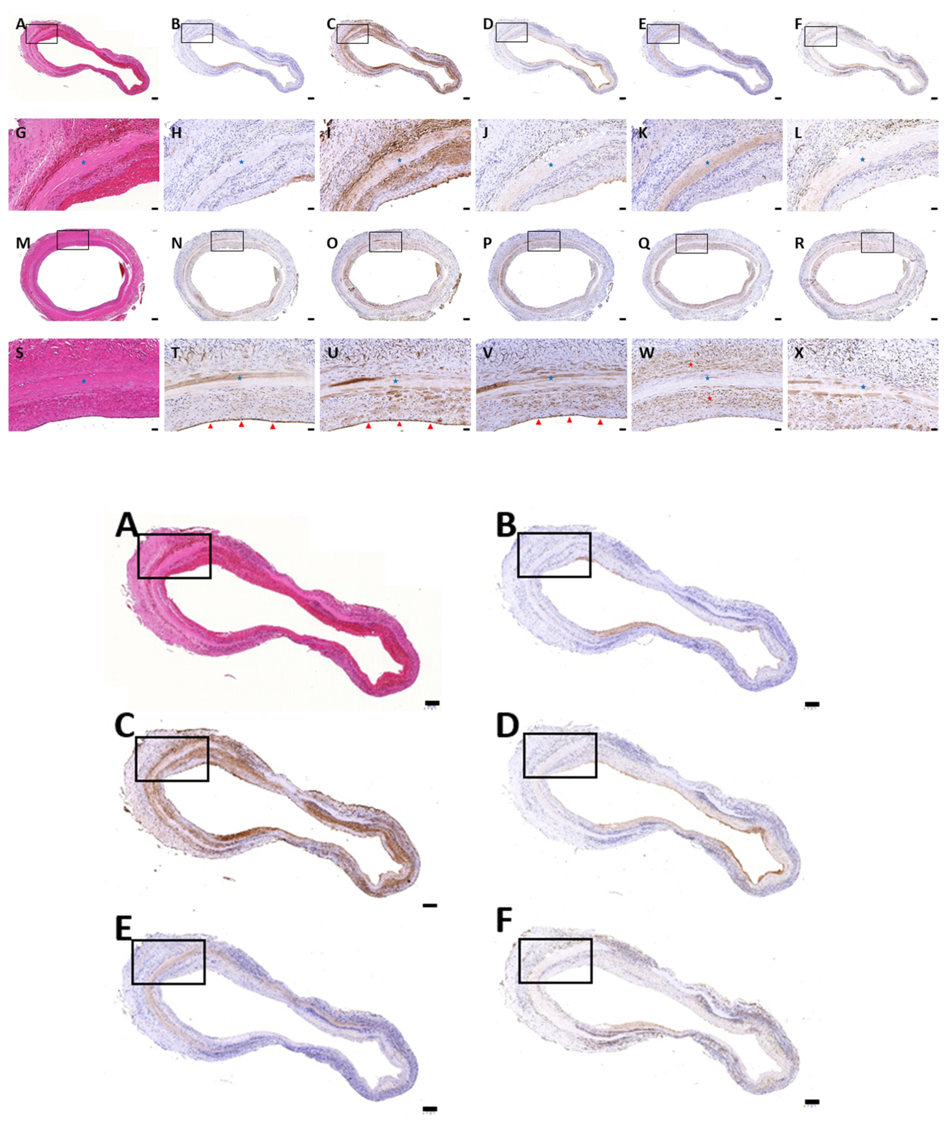 Polymers Free Full Text Sonication Assisted Method For Decellularization Of Human Umbilical Artery For Small Caliber Vascular Tissue Engineering Html