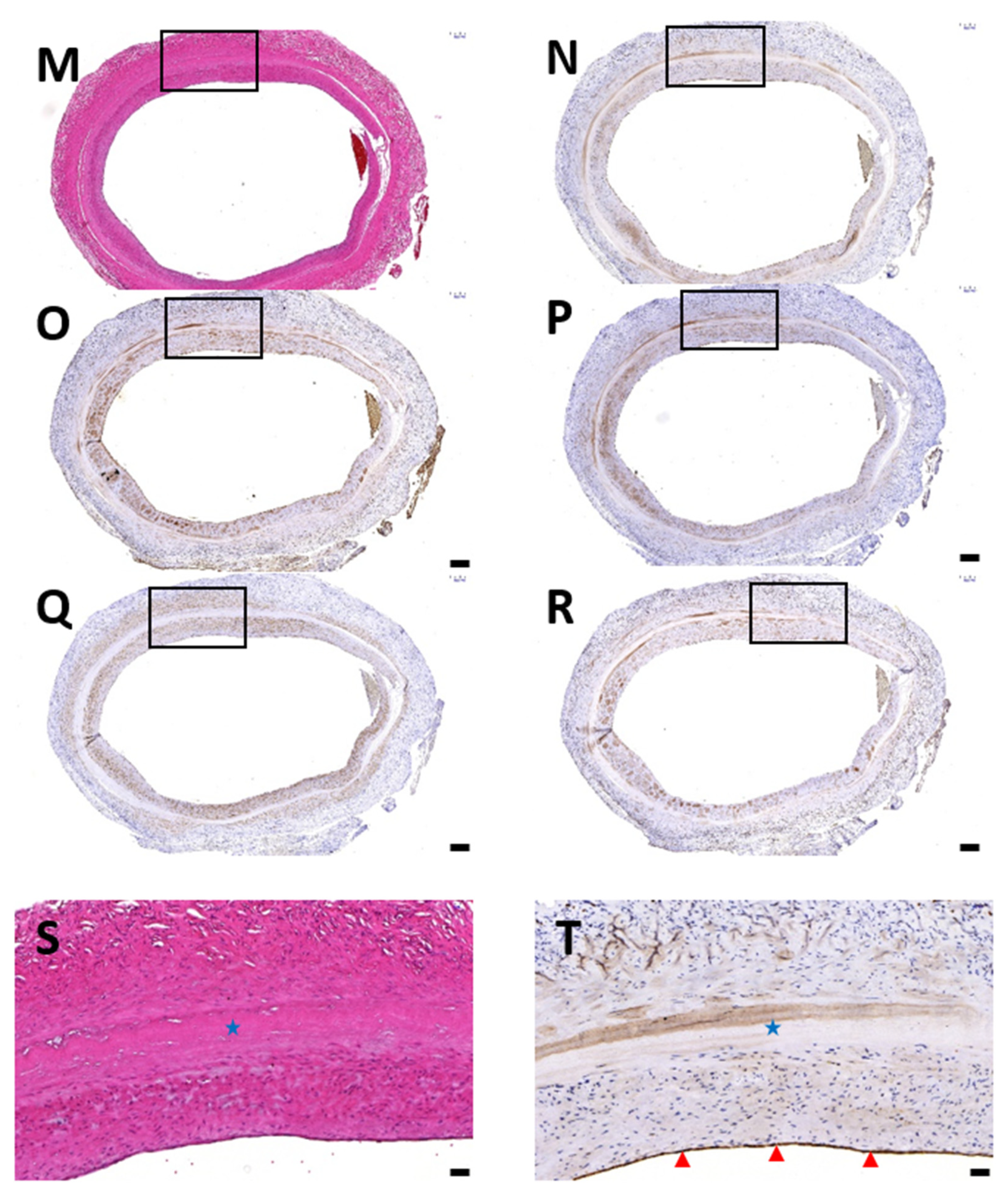 Polymers Free Full Text Sonication Assisted Method For Decellularization Of Human Umbilical Artery For Small Caliber Vascular Tissue Engineering Html