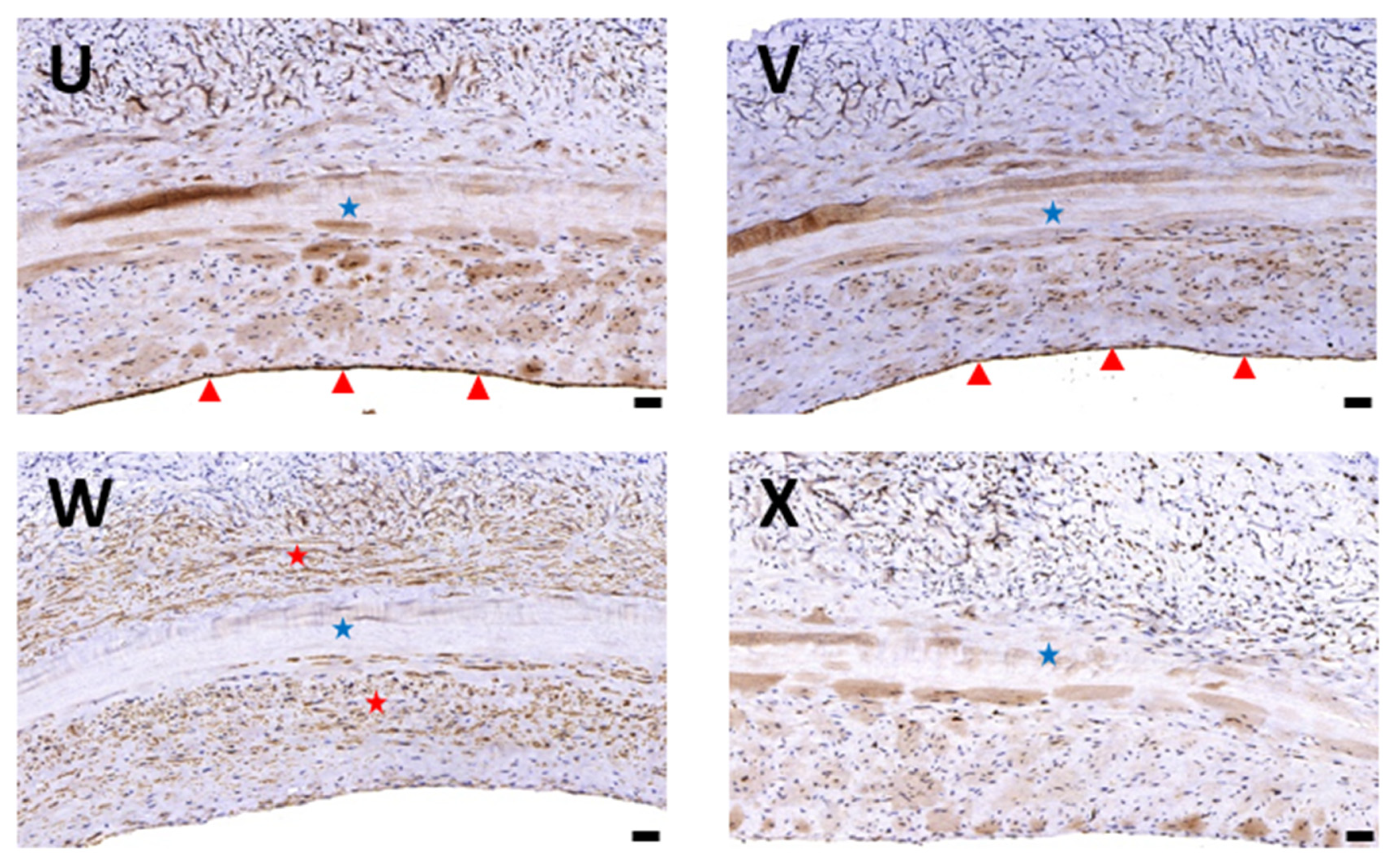 Polymers Free Full Text Sonication Assisted Method For Decellularization Of Human Umbilical Artery For Small Caliber Vascular Tissue Engineering Html