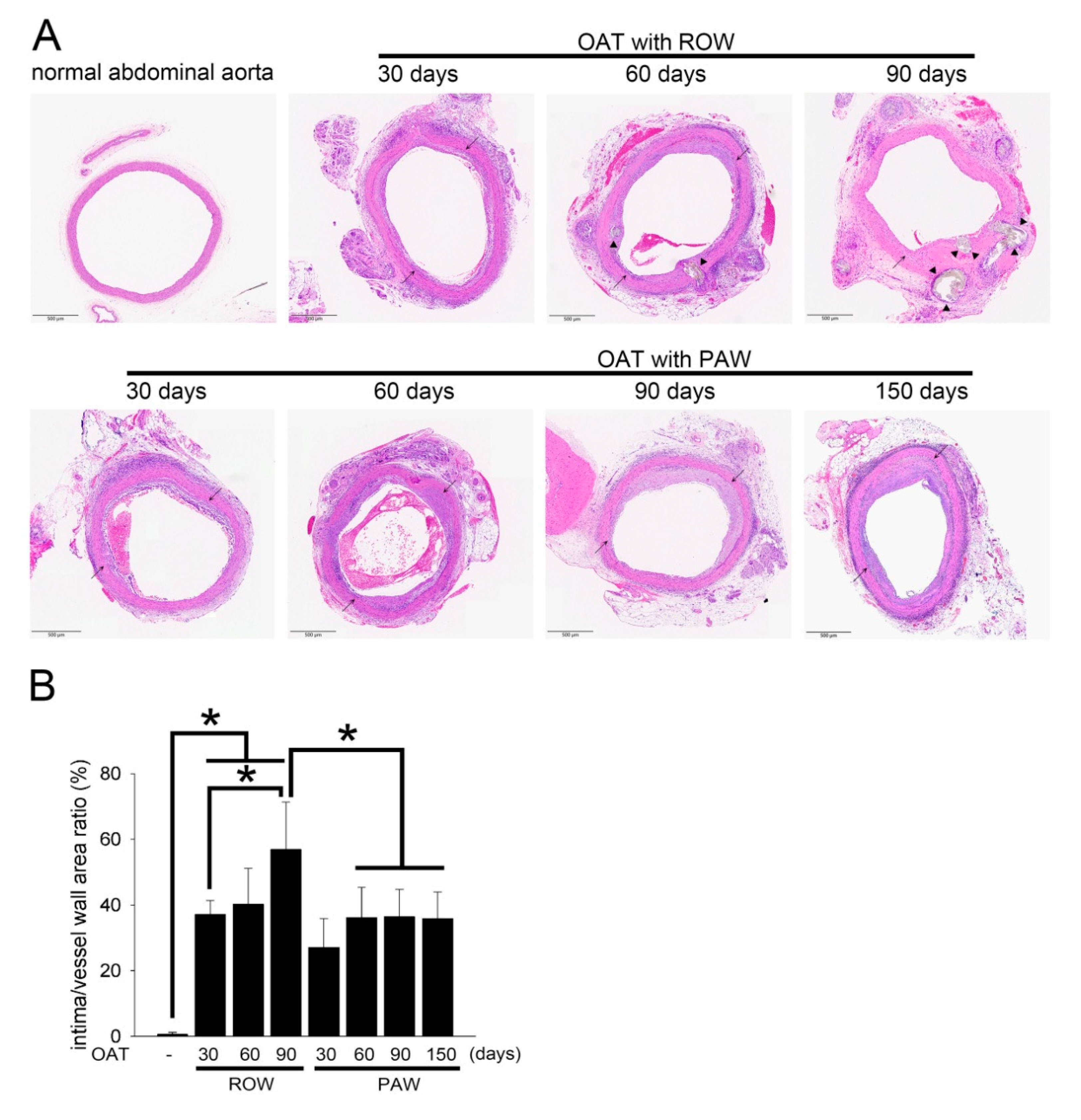 Polymers Free Full Text Transferring Plasmon Effect On A Biological System Expression Of Biological Polymers In Chronic Rejection And Inflammatory Rat Model Html Polymers Free Full Text Transferring Plasmon Effect On A Biological System Expression Of Biological Polymers In Chronic Rejection And Inflammatory Rat Model Html