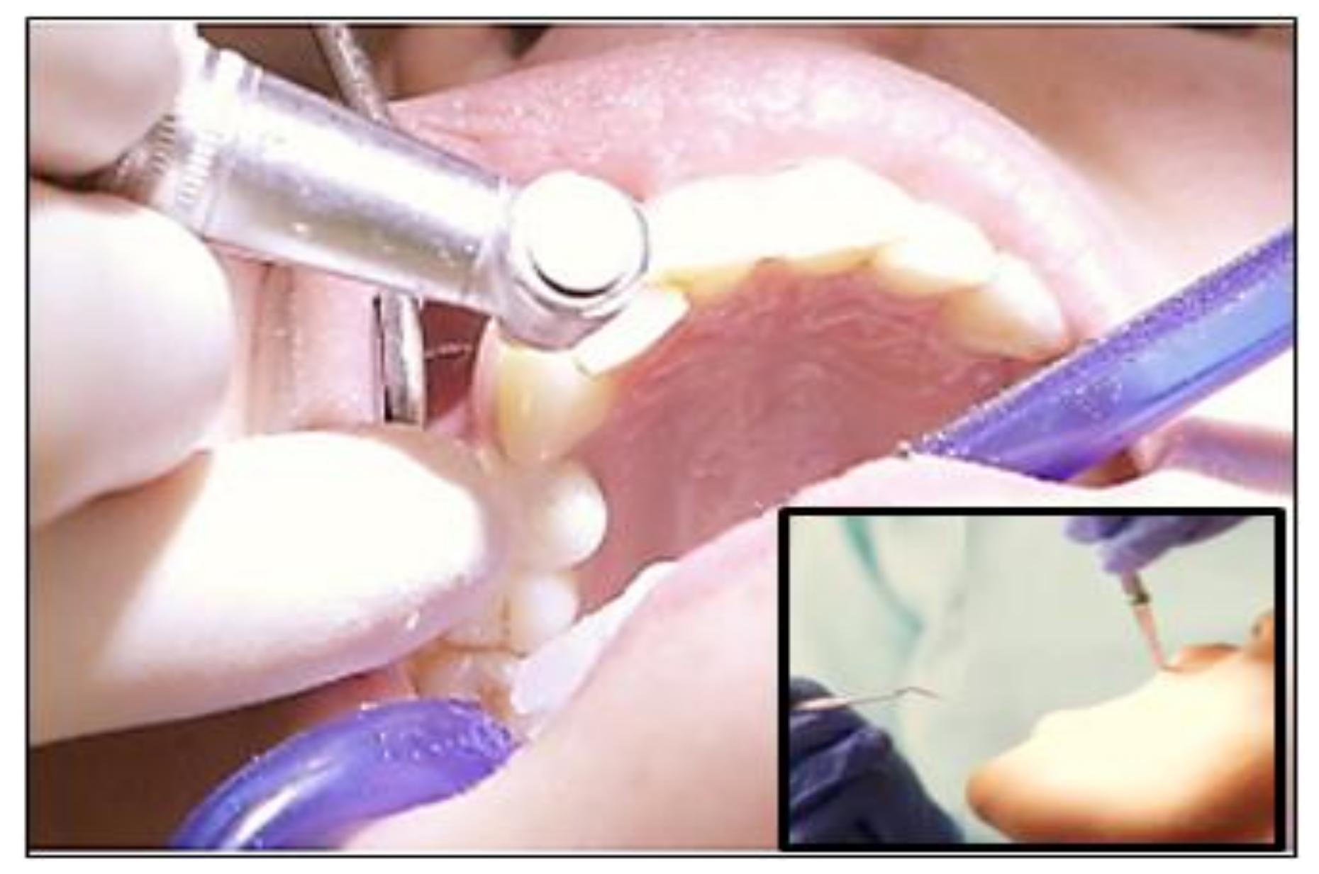 Polymers 13 01865 g015 Polymers 13 01865 g015