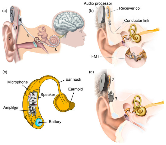Polymers Free Full Text Mechanical Energy Sensing And Harvesting In Micromachined Polymer Based Piezoelectric Transducers For Fully Implanted Hearing Systems A Review Html