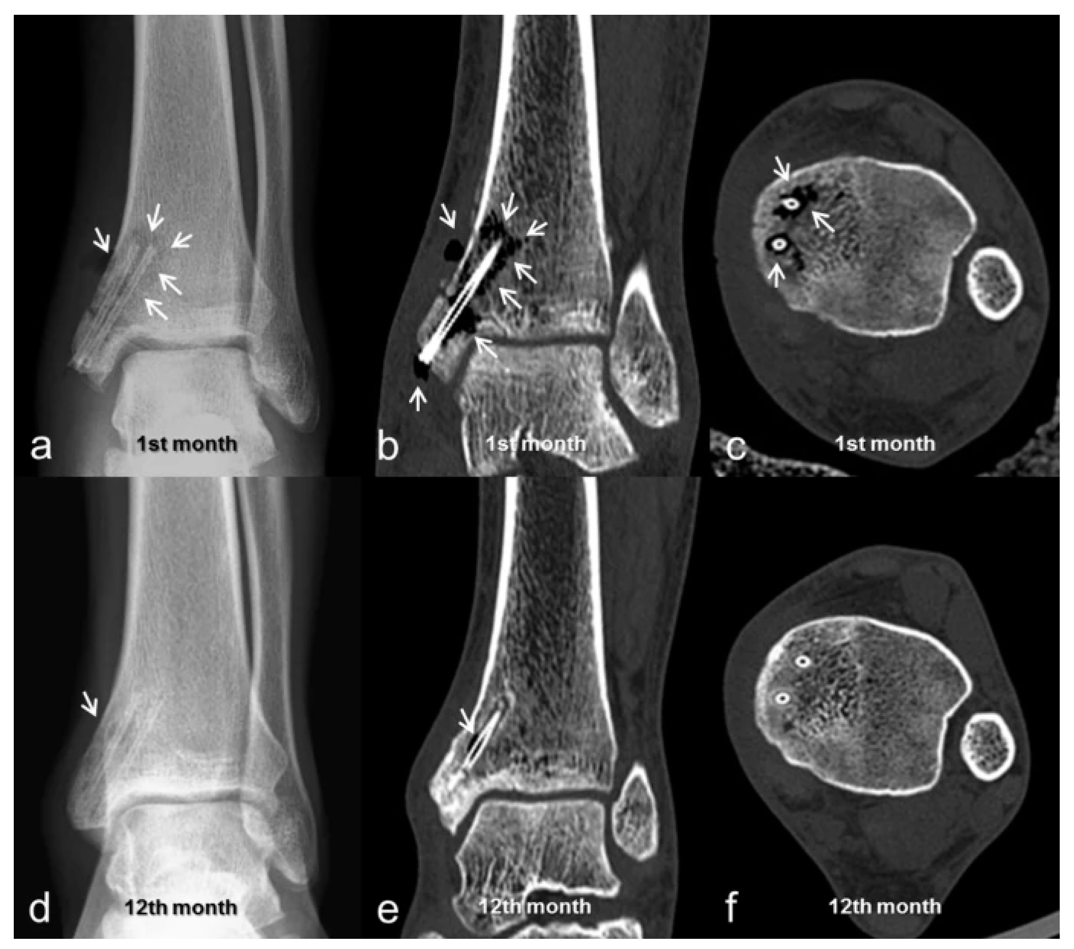 Polymers 13 02348 g004
