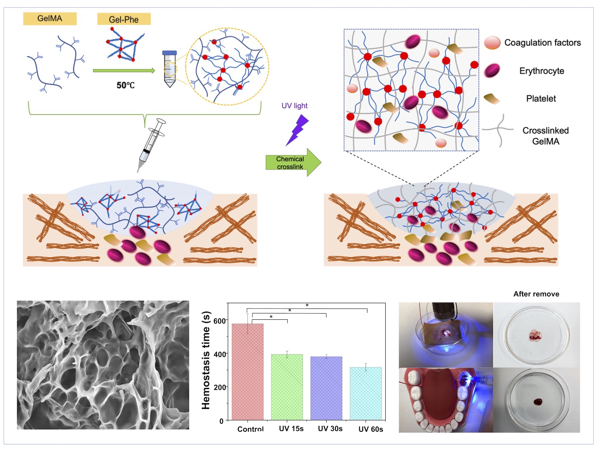 Polymers Free FullText An Injectable Hybrid Gelatin Methacryloyl