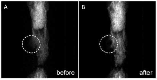 Recent Advances in Multimodal Molecular Imaging of Cancer Mediated by ...