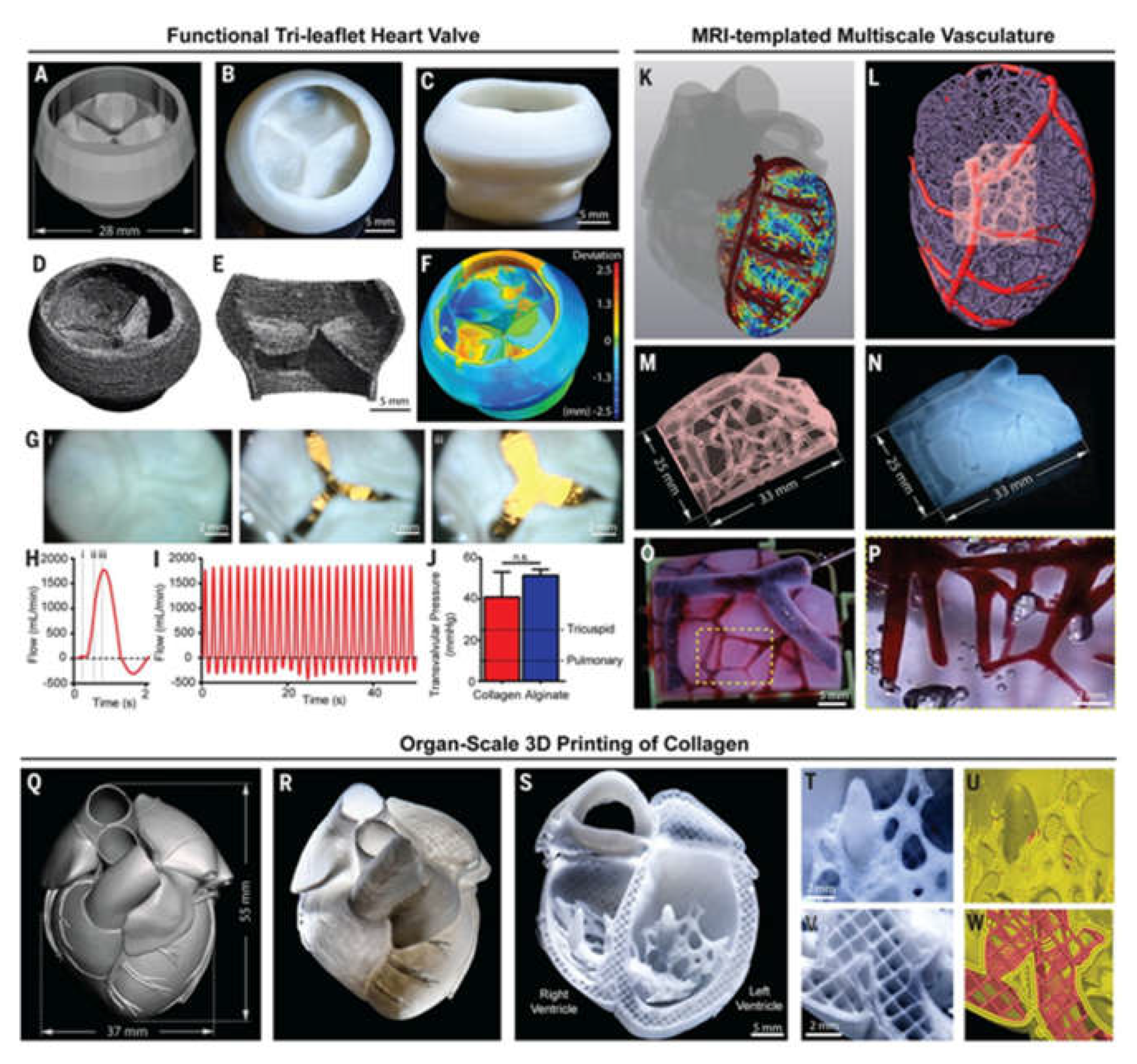 Progress of 3D Bioprinting in Organ Manufacturing