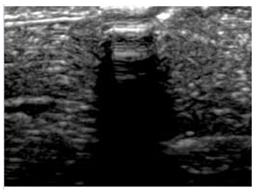 Polymers 14 00722 i021