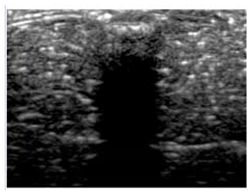 Polymers 14 00722 i030