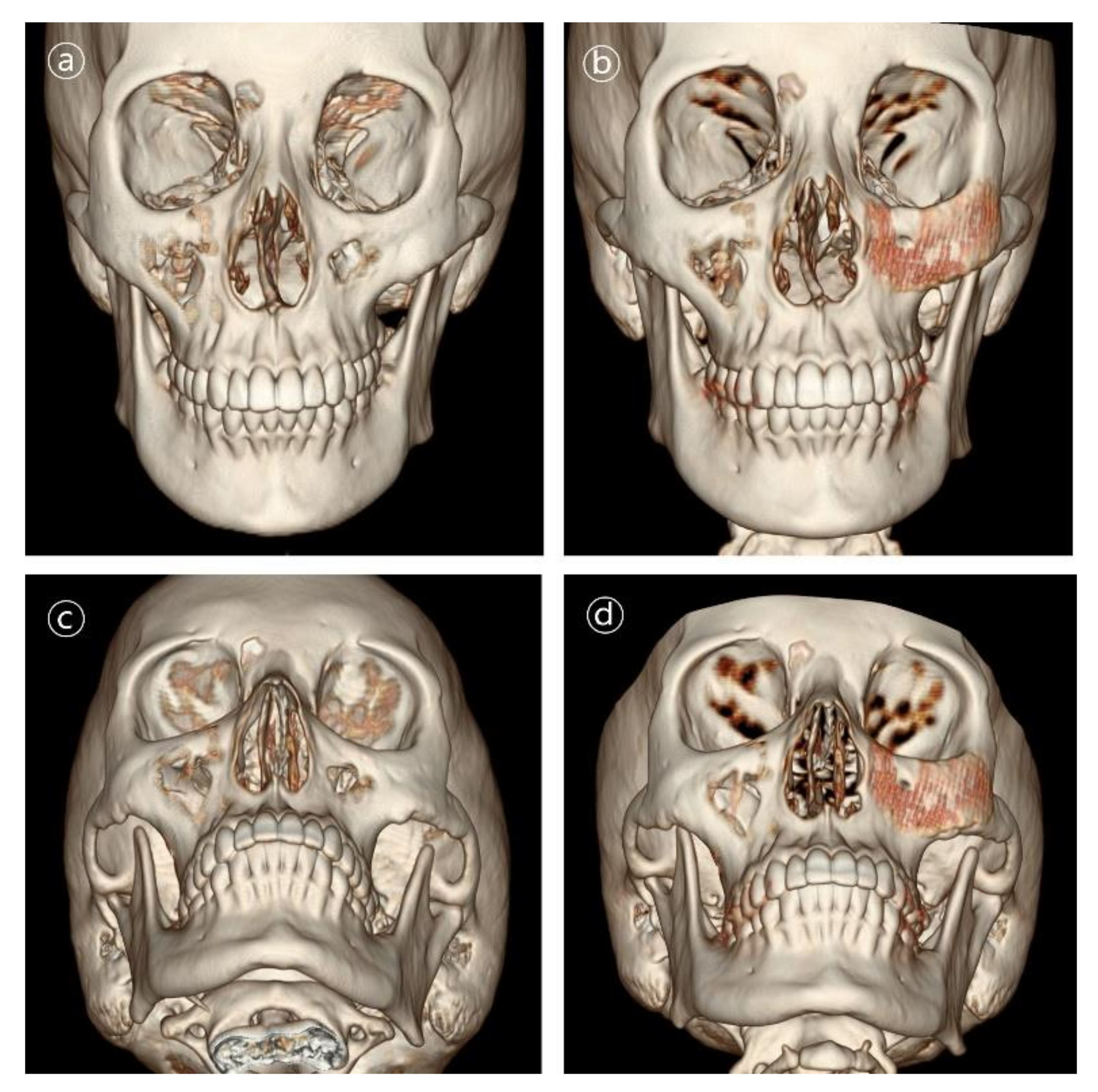 Polymers 14 00740 g006 550