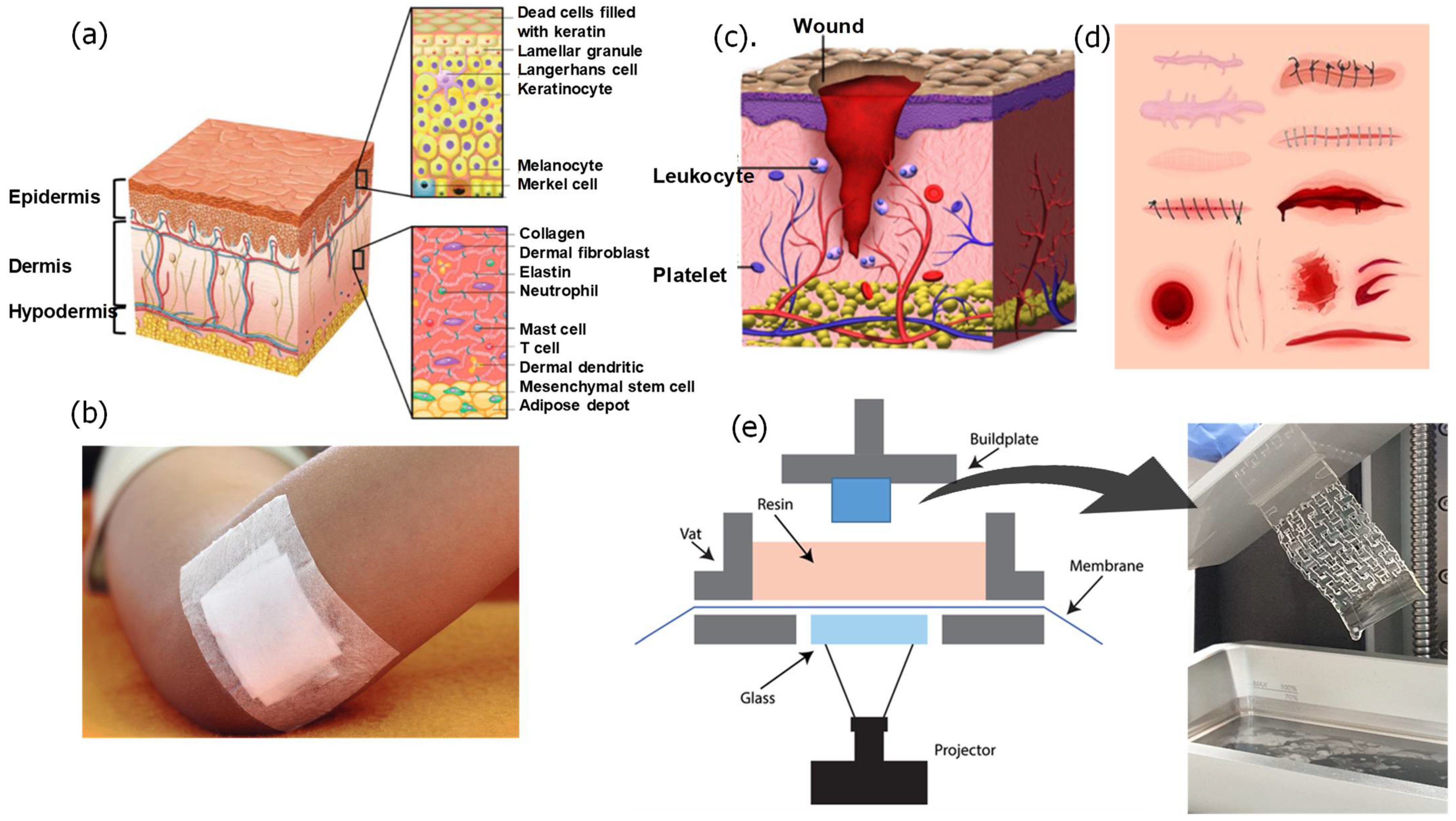 Dermabond liquid adhesive providing hemostasis to a child's laceration