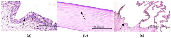 Nanoparticles Loaded Thermoresponsive In Situ Gel for Ocular Antibiotic ...