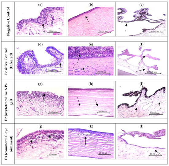 Nanoparticles Loaded Thermoresponsive In Situ Gel for Ocular Antibiotic ...