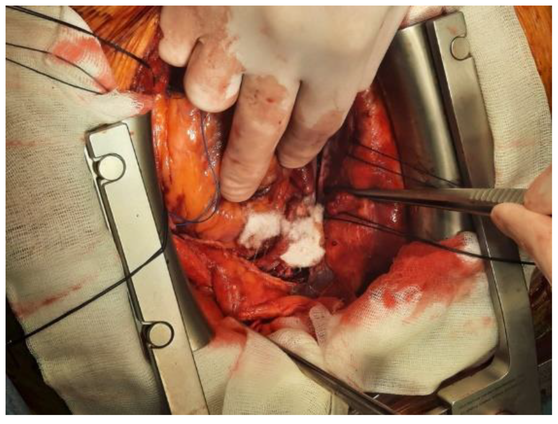 Polymers 14 01189 g003 Polymers 14 01189 g003