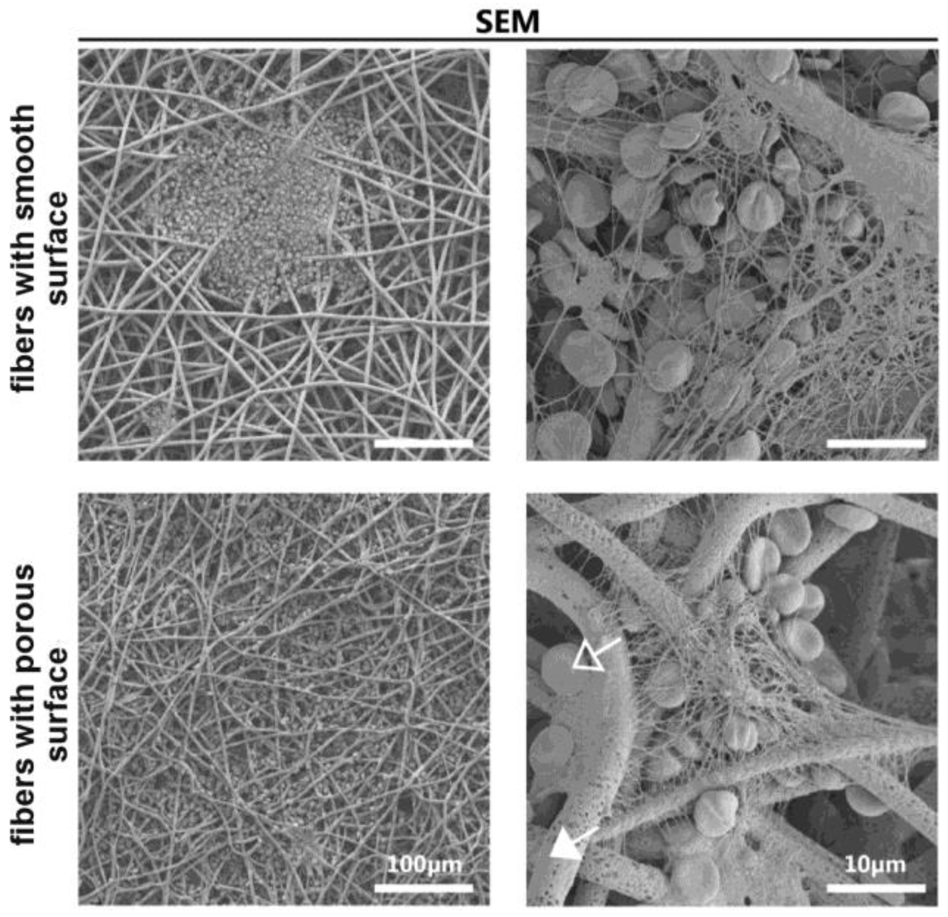 Polymers 14 01698 g005 Polymers 14 01698 g005