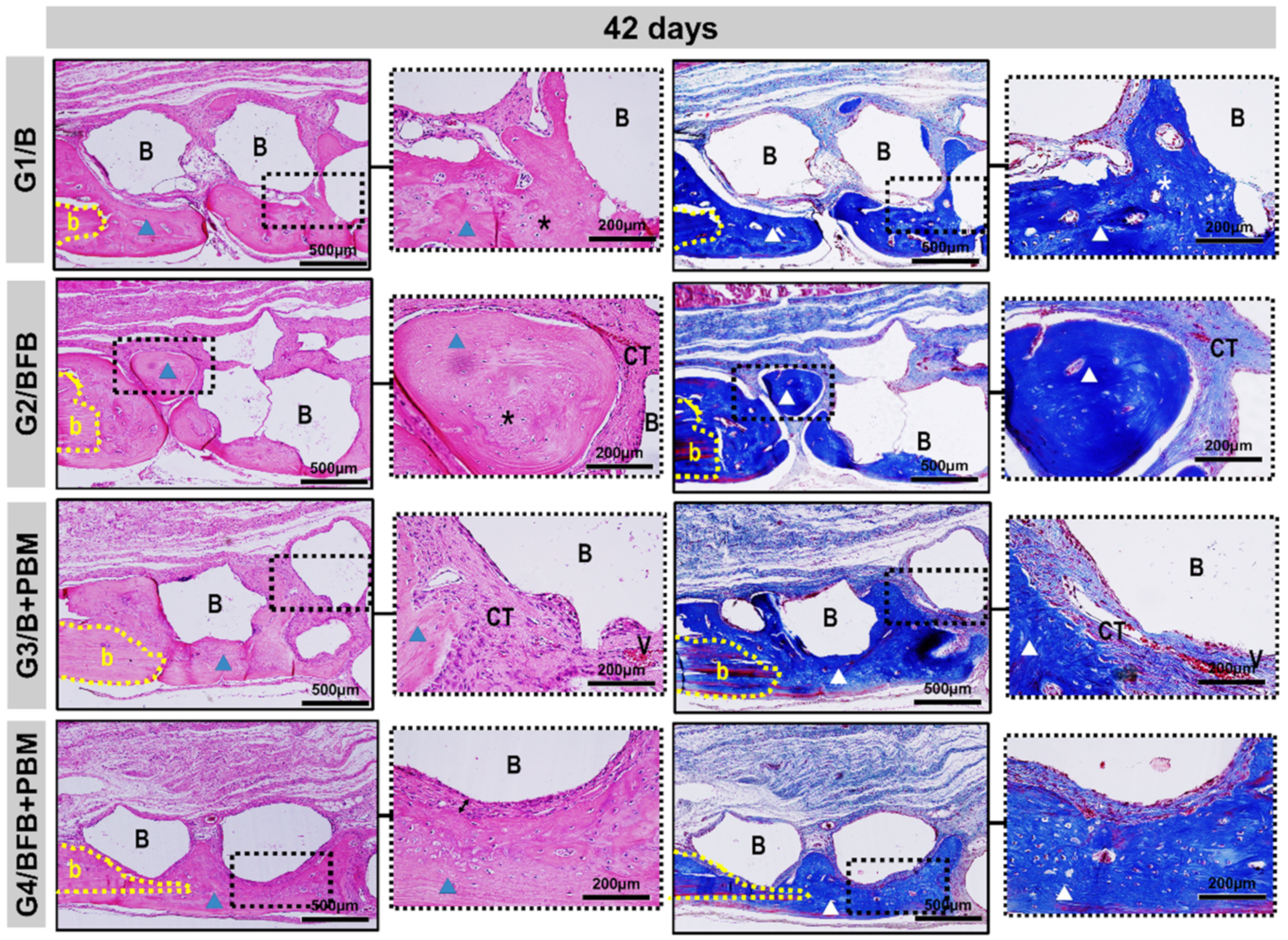 Polymers 14 02075 g008 Polymers 14 02075 g008