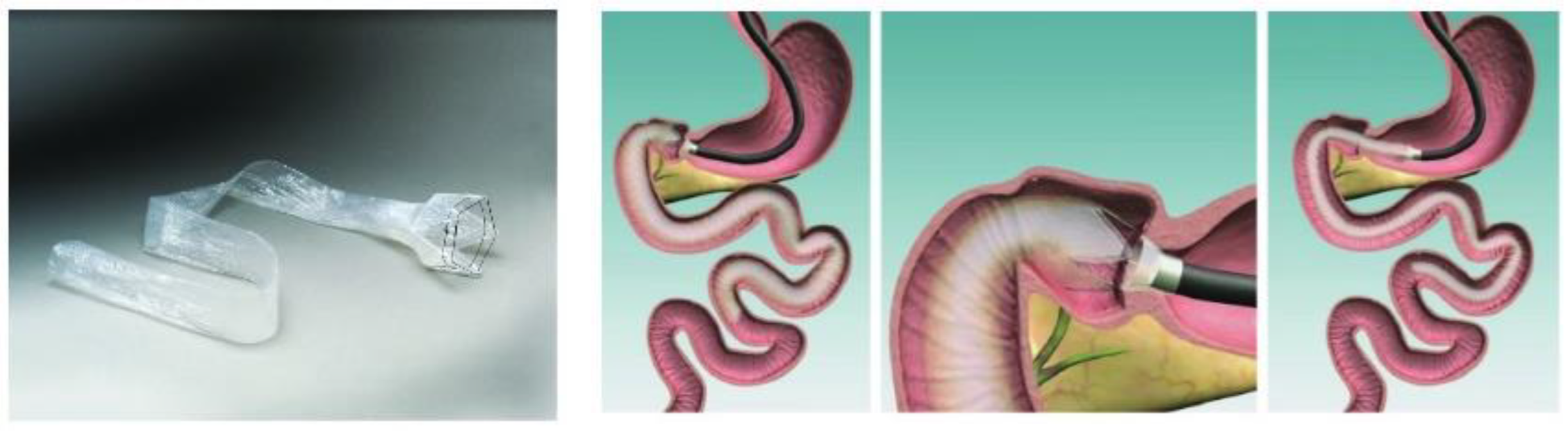 Polymers 14 02178 g001 550