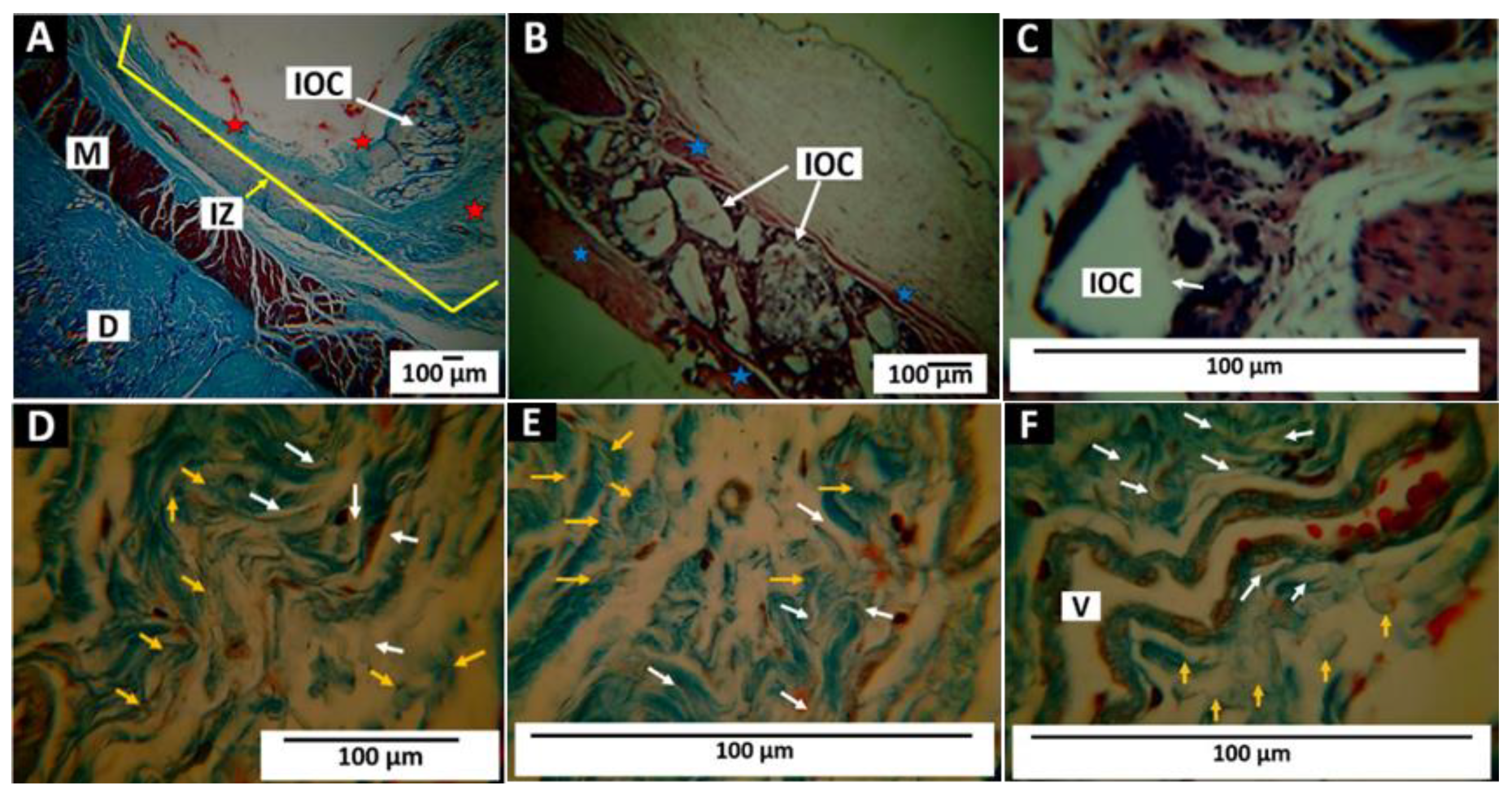 Polymers 14 02672 g012