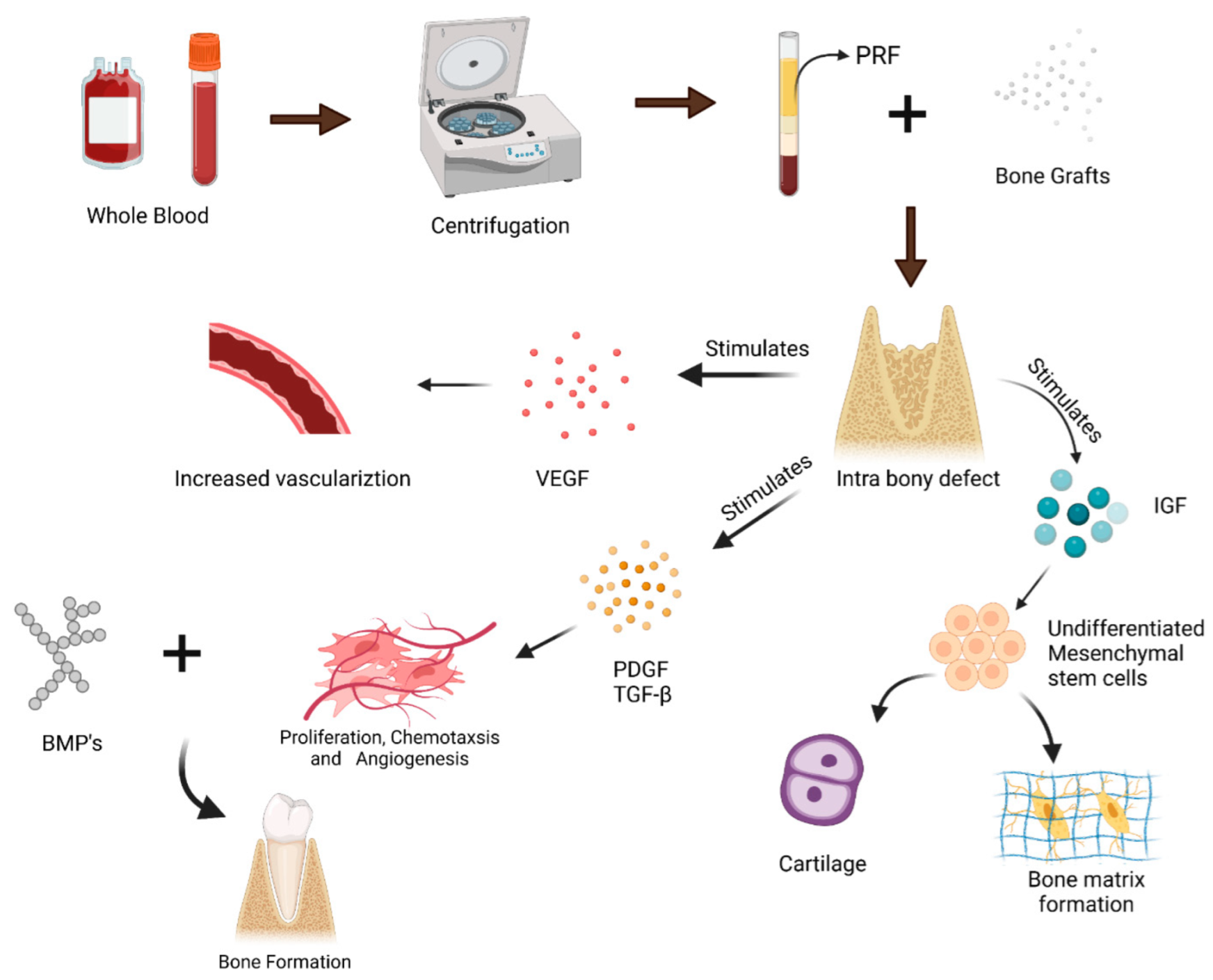Polymers Free FullText Role of Biomaterials Used for Periodontal