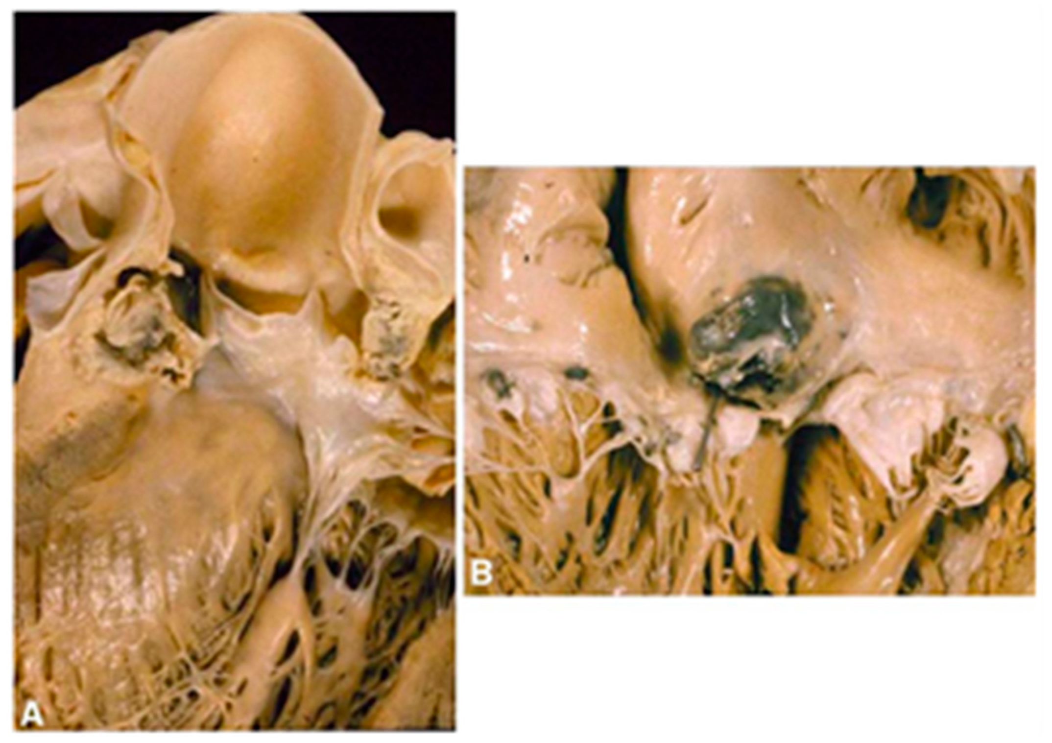 Polymers 14 03198 g001 Polymers 14 03198 g001