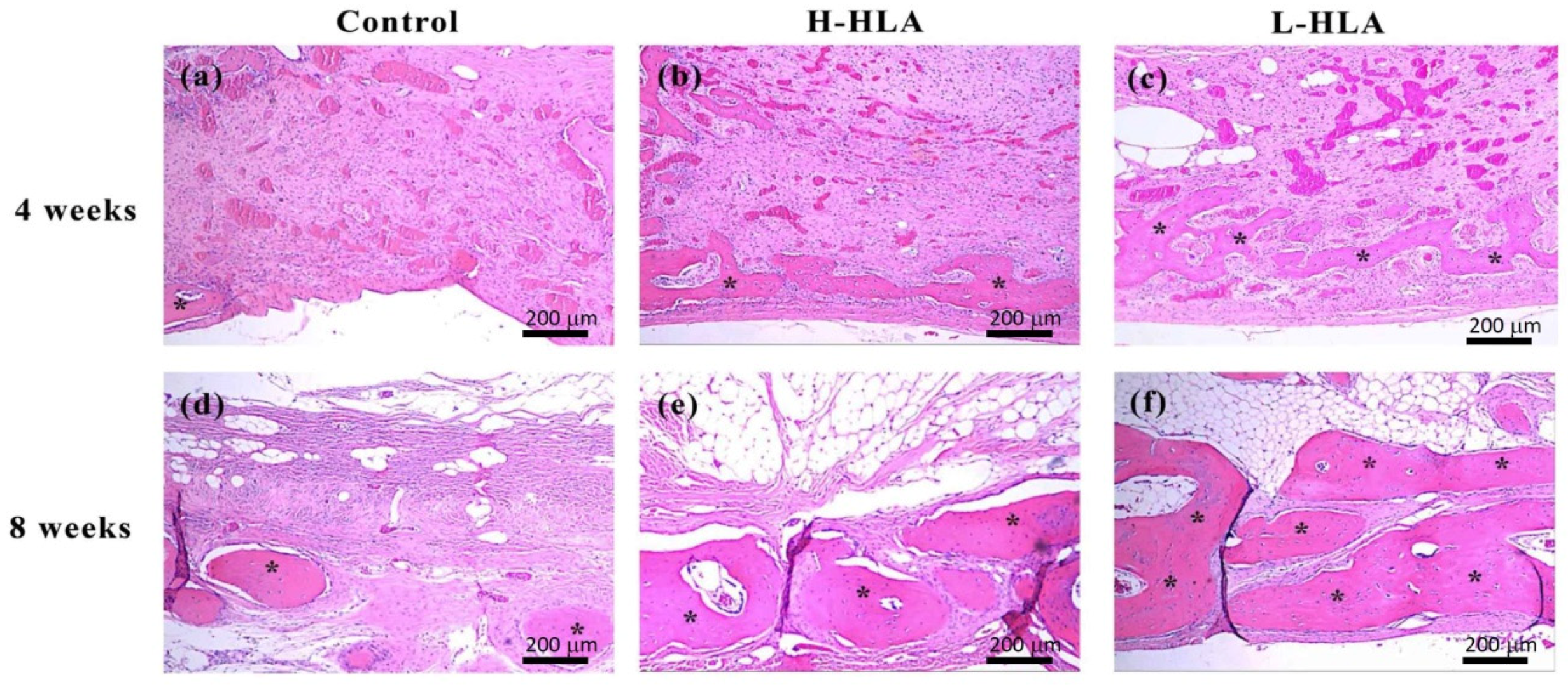 Polymers 14 03211 g008 Polymers 14 03211 g008