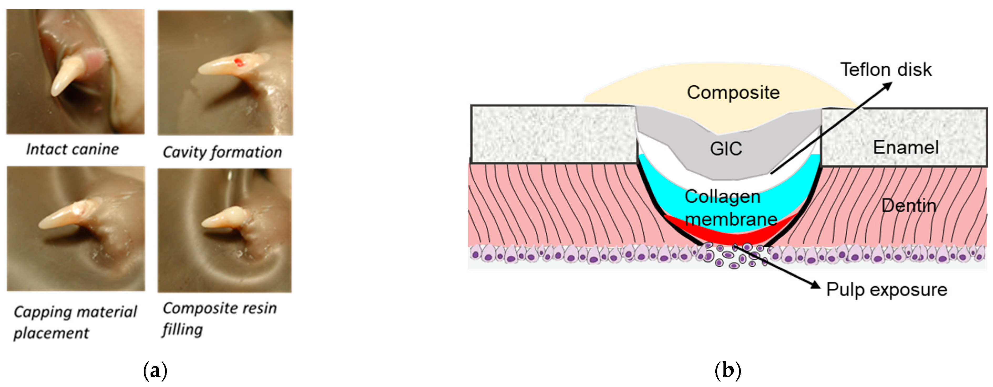 Polymers Free FullText Dentin Sialoprotein/Phosphophoryn (DSP/PP