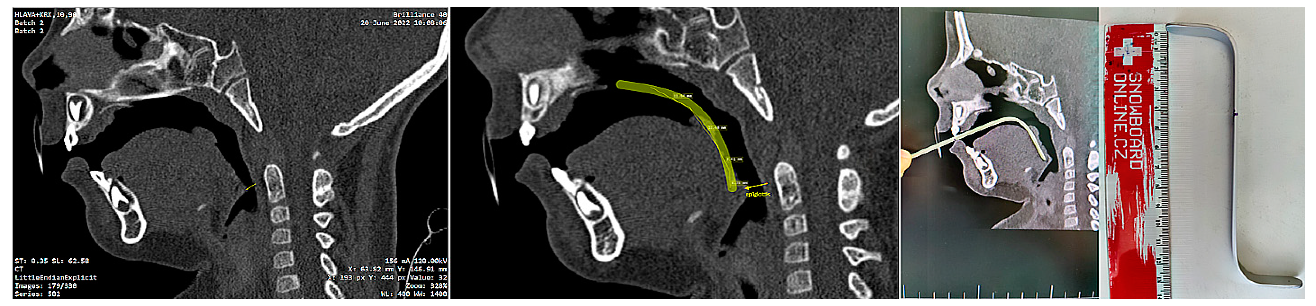 Polymers 14 03858 g007 550
