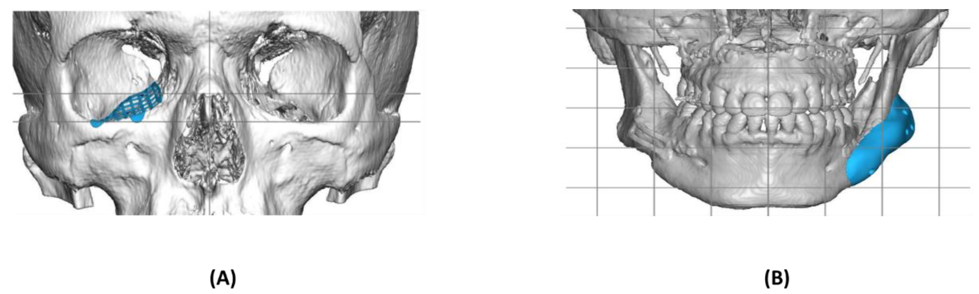 Polymers 14 03862 g001 Polymers 14 03862 g001