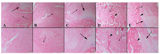 Bone Healing in Rat Segmental Femur Defects with Graphene-PCL-Coated ...