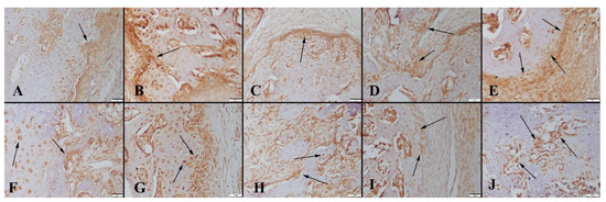 Bone Healing in Rat Segmental Femur Defects with Graphene-PCL-Coated ...