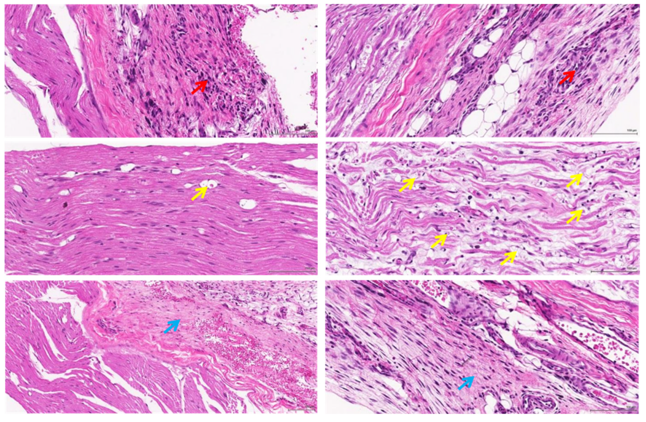 Polymers 14 04272 g009 Polymers 14 04272 g009