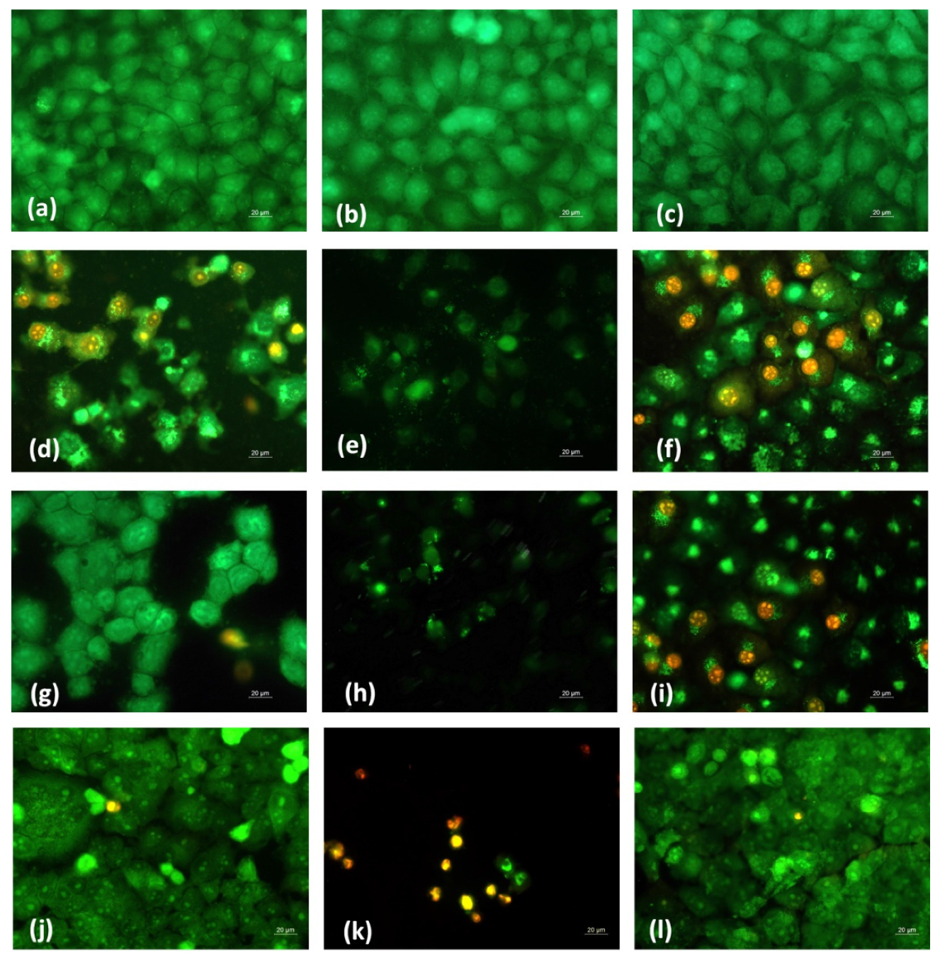 Polymers 14 05002 g012 Polymers 14 05002 g012