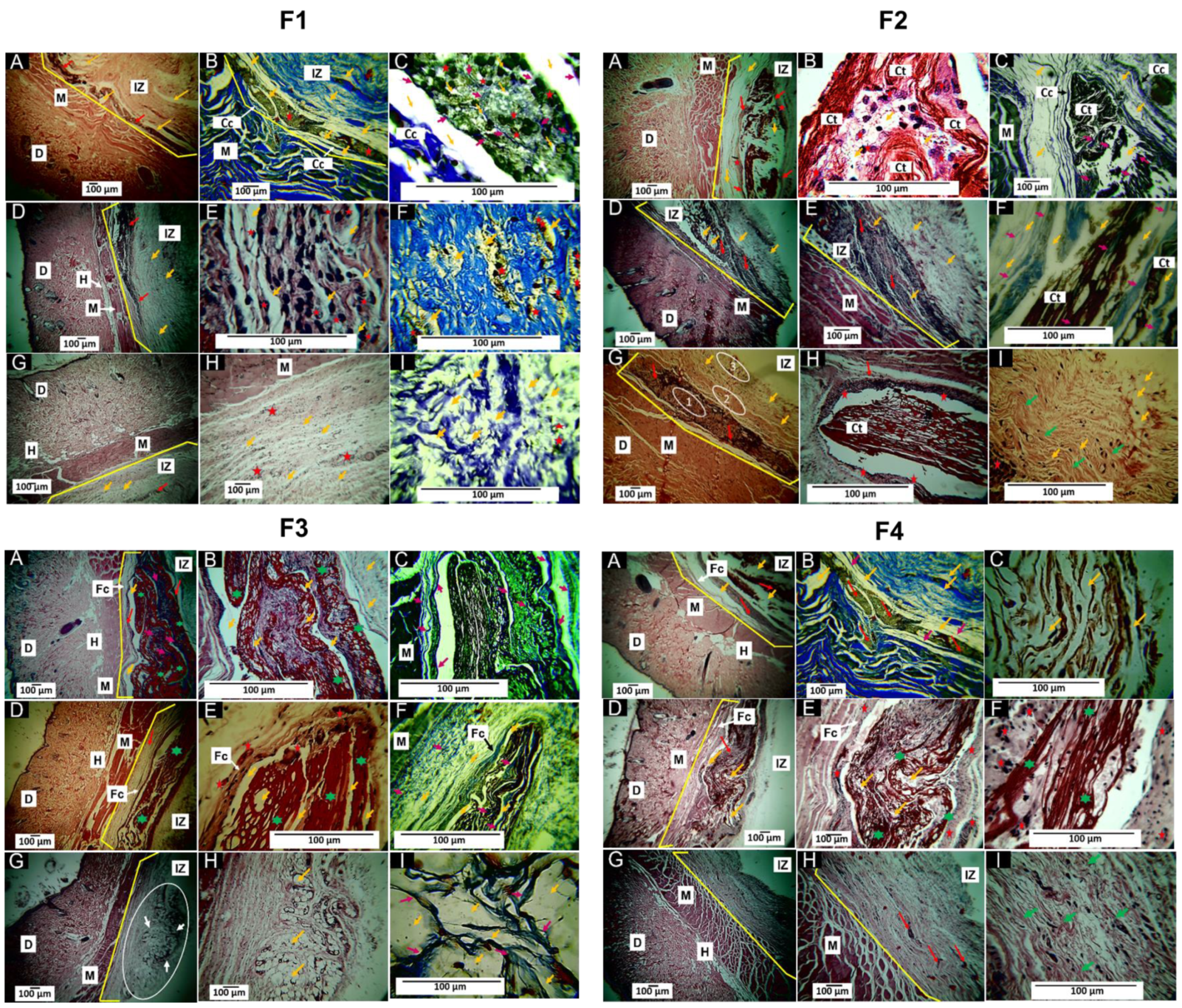 Polymers 15 00135 g008
