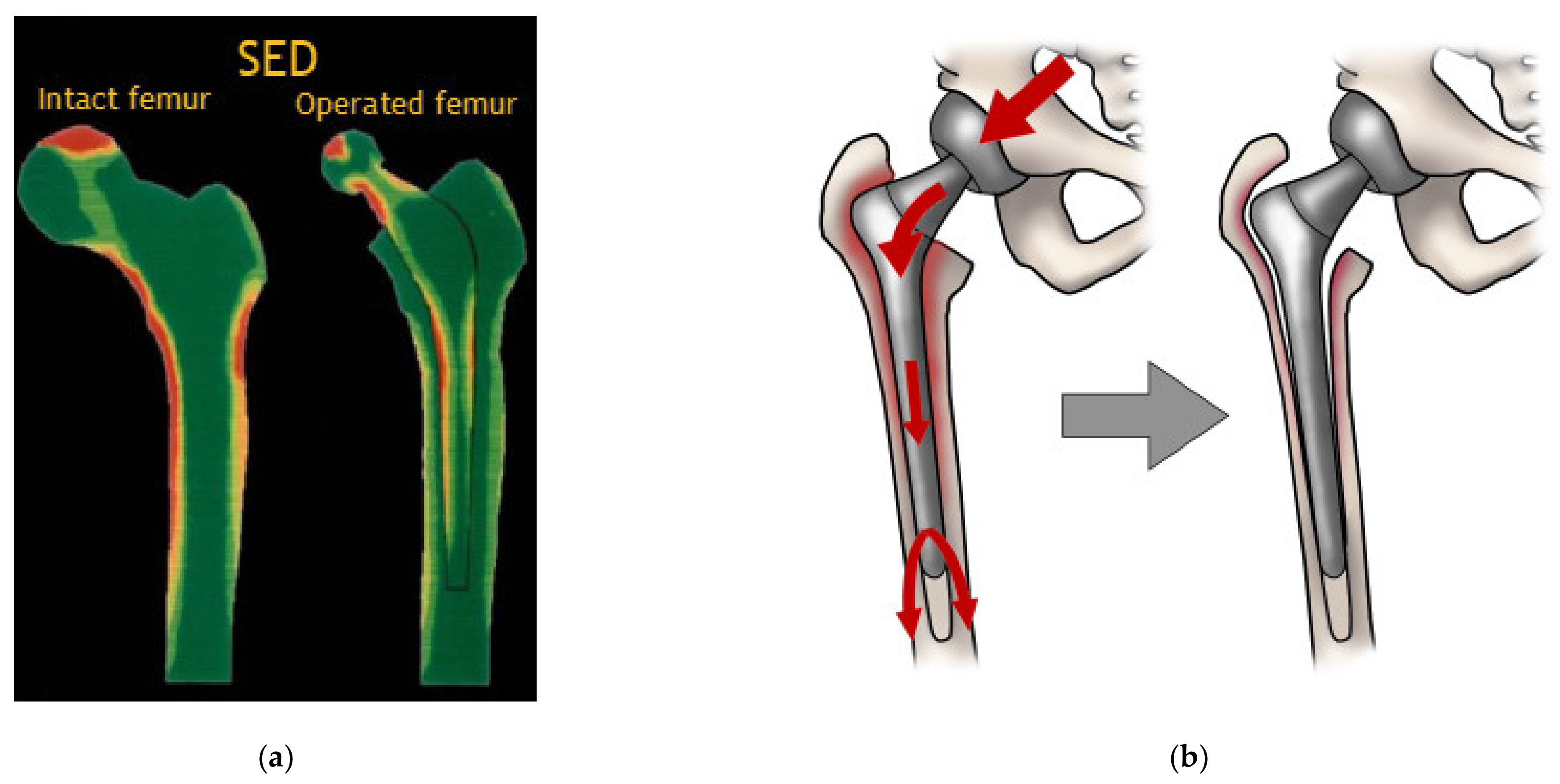 Polymers 15 00373 g003 Polymers 15 00373 g003