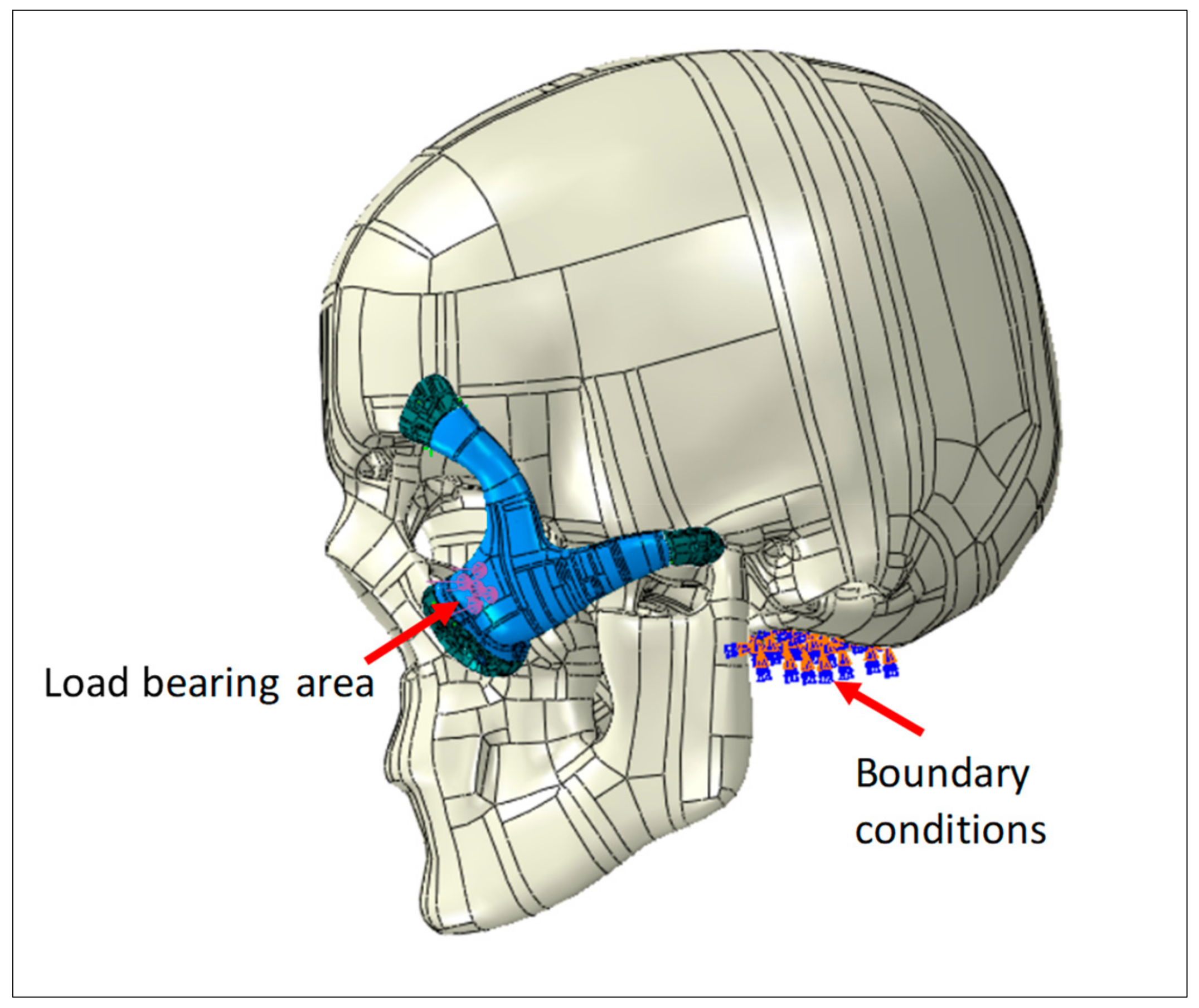 Polymers Free FullText Design, Analysis, and 3D Printing of a